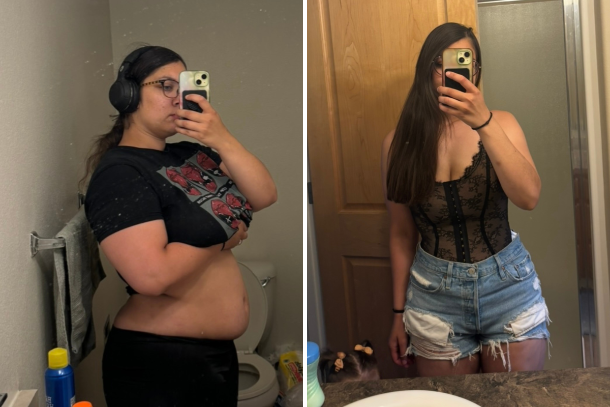 Weight loss