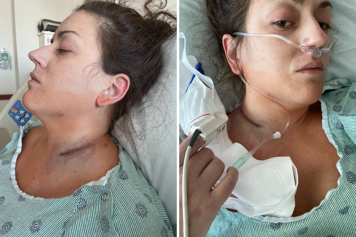 Surgery