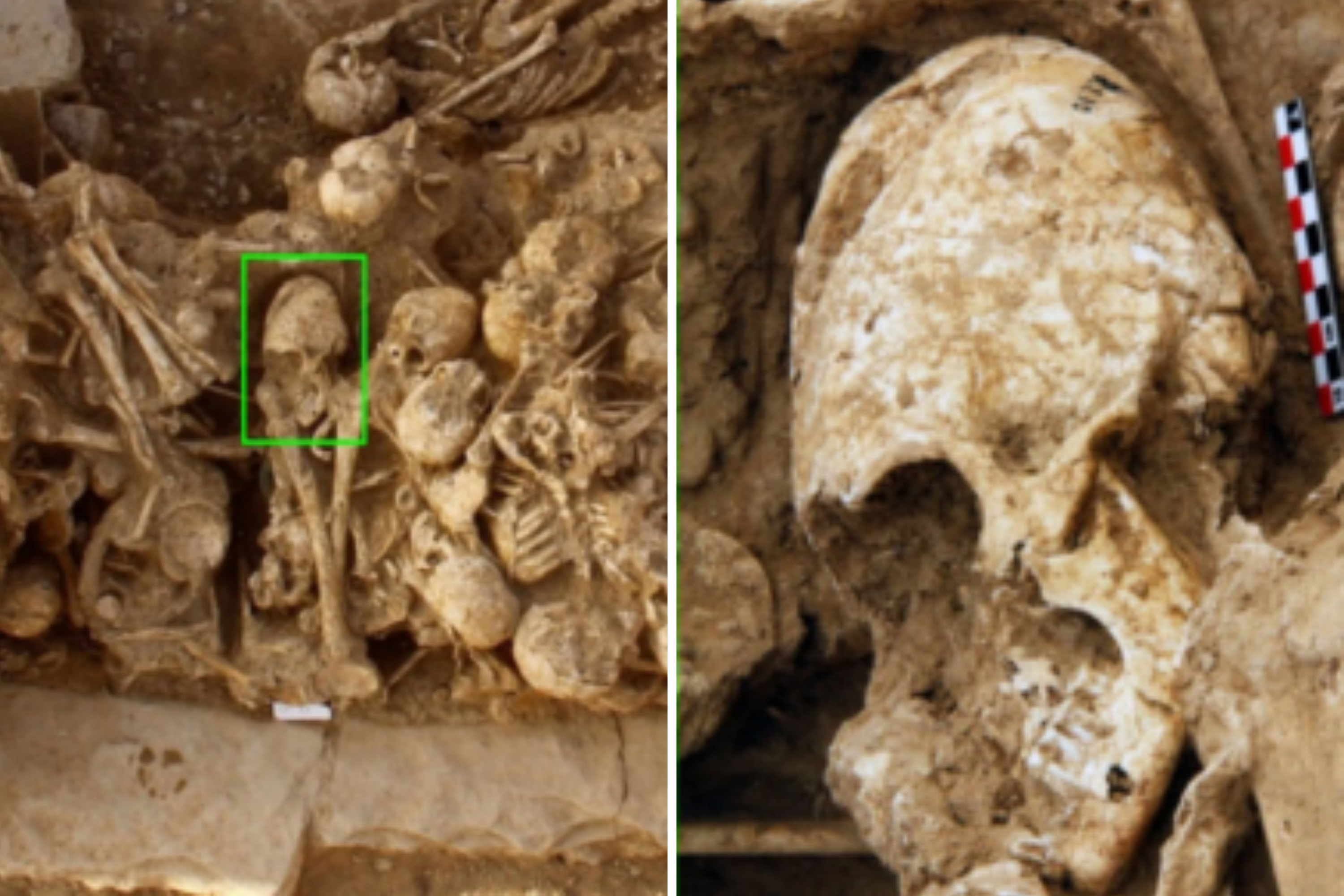 Archaeologists Find Cone-Headed Girls Skull From 6,200 Years Ago