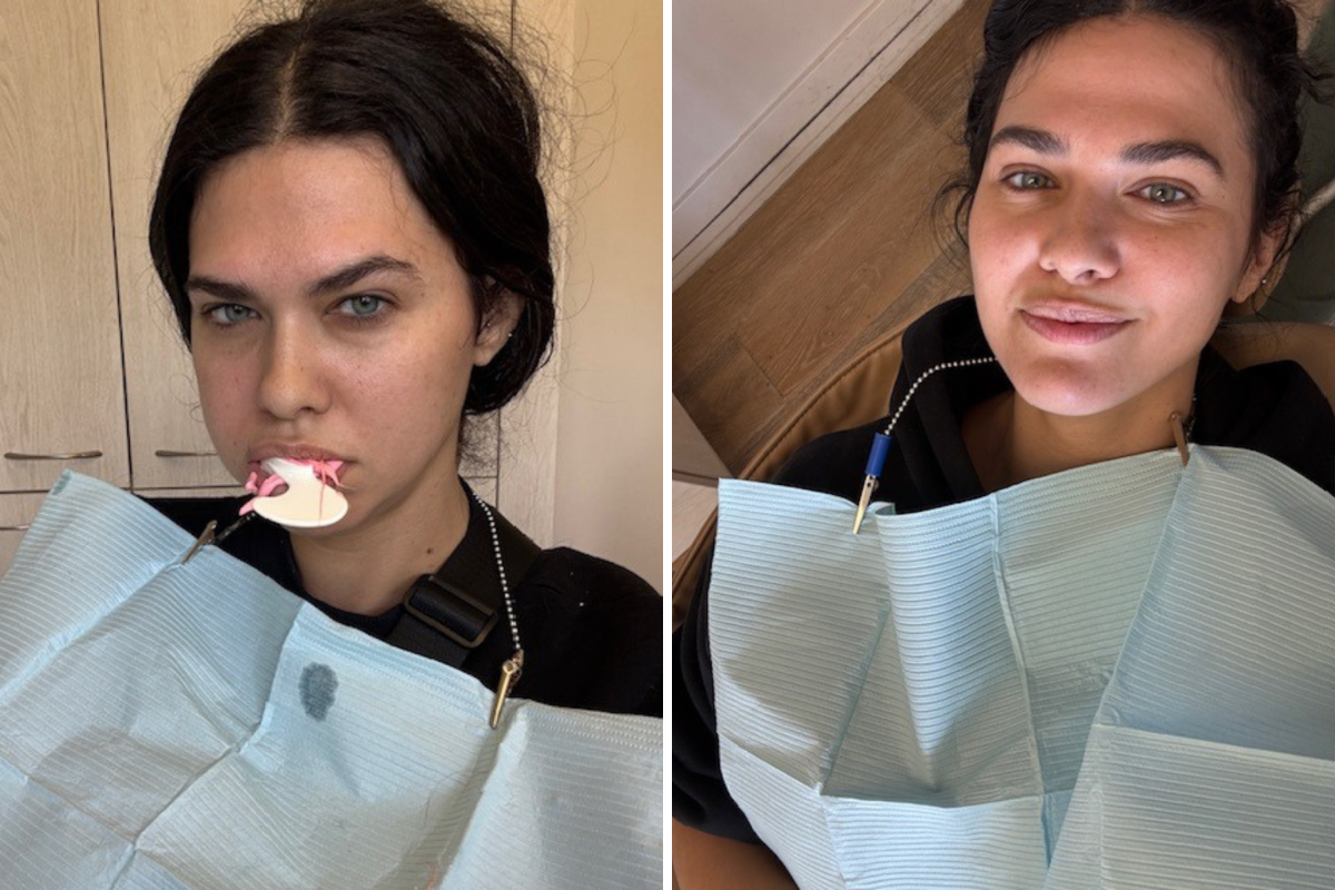 Dentista de Jess Adams