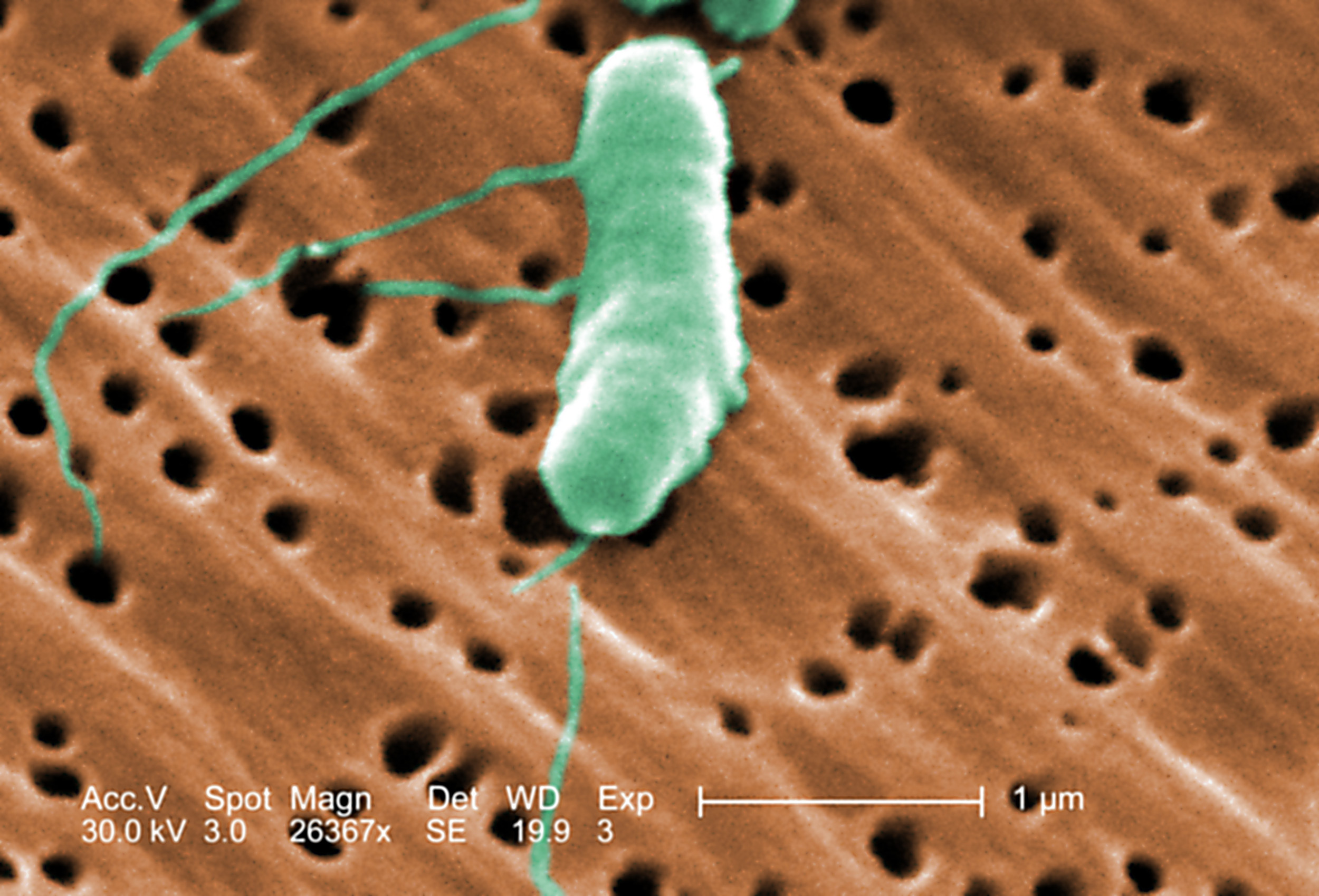 Flesh-Eating Bacteria Kills Four, Infects 11 Across Florida 2025