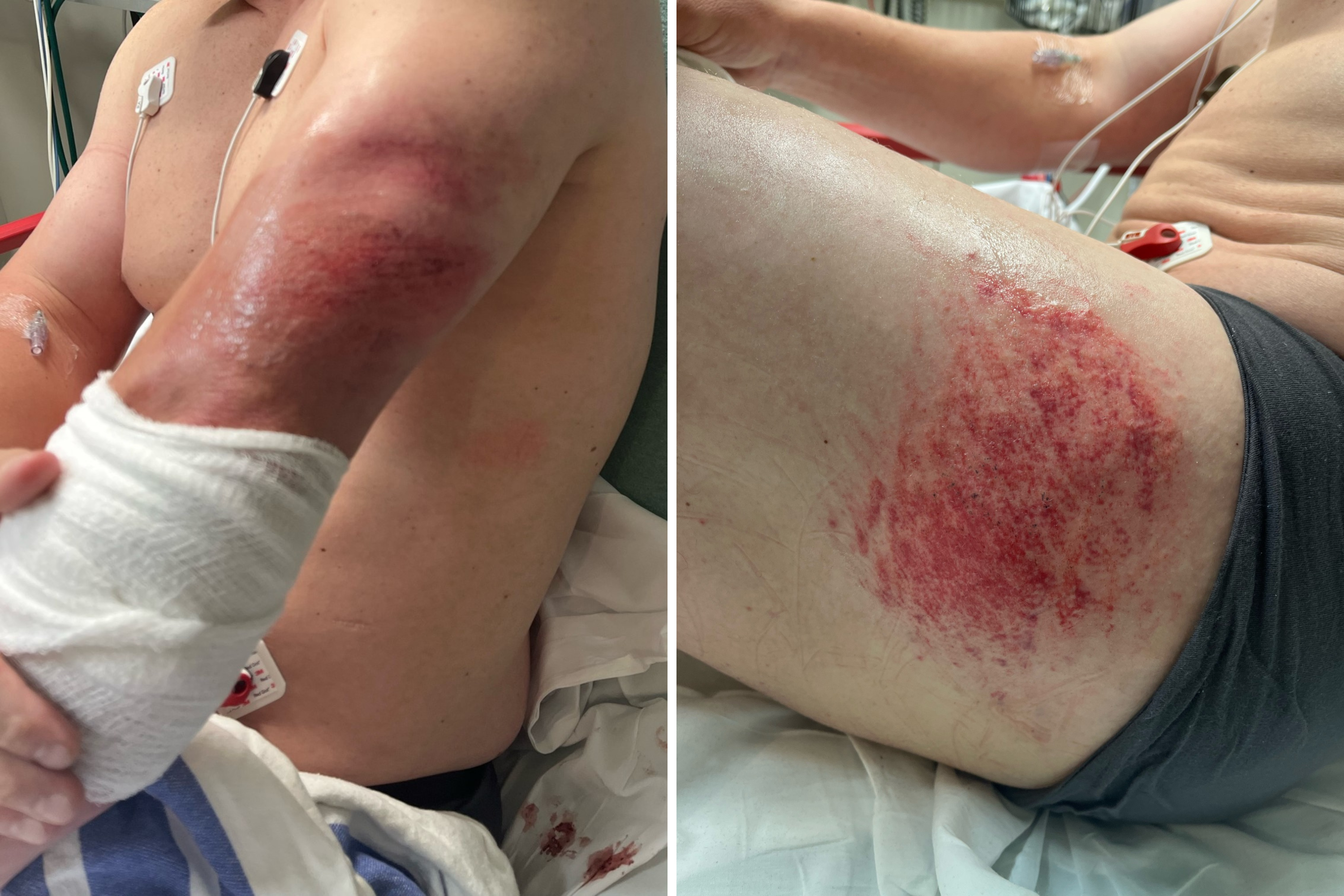 ICE Agent Dragged Nearly Block by Honduran Migrant in Oklahoma City Amid Assault Spike
