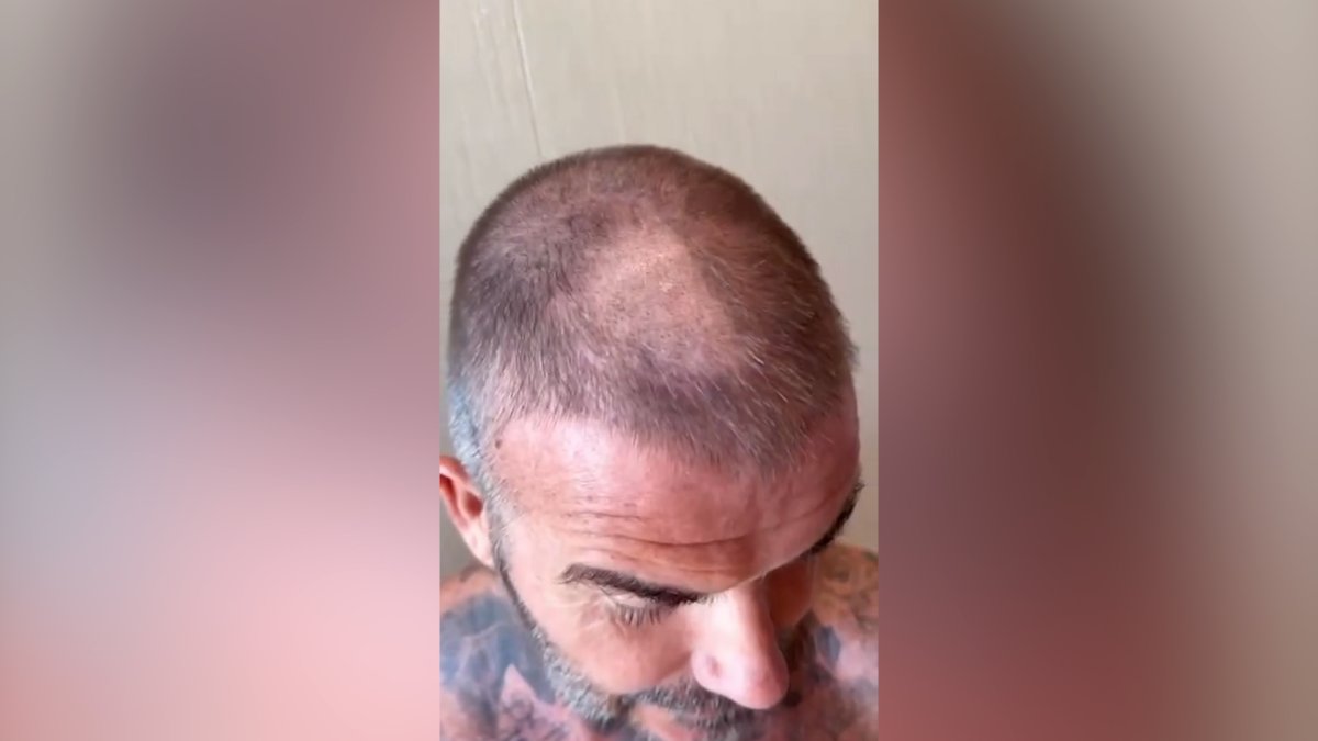 David Beckham compartilha o horrível corte de cabelo acidental