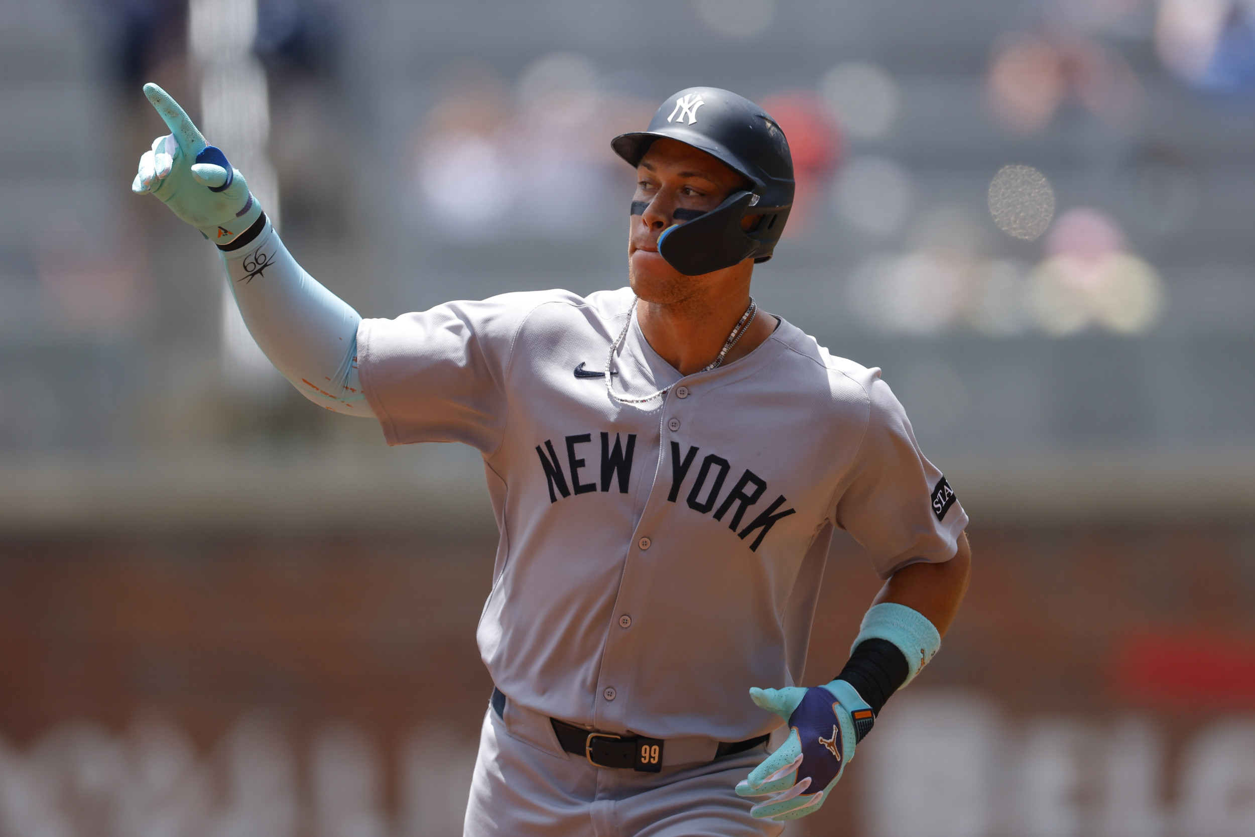 “Conservative Alert: Aaron Judge’s Elbow Injury Exposed by Yankees’ Head Coach”