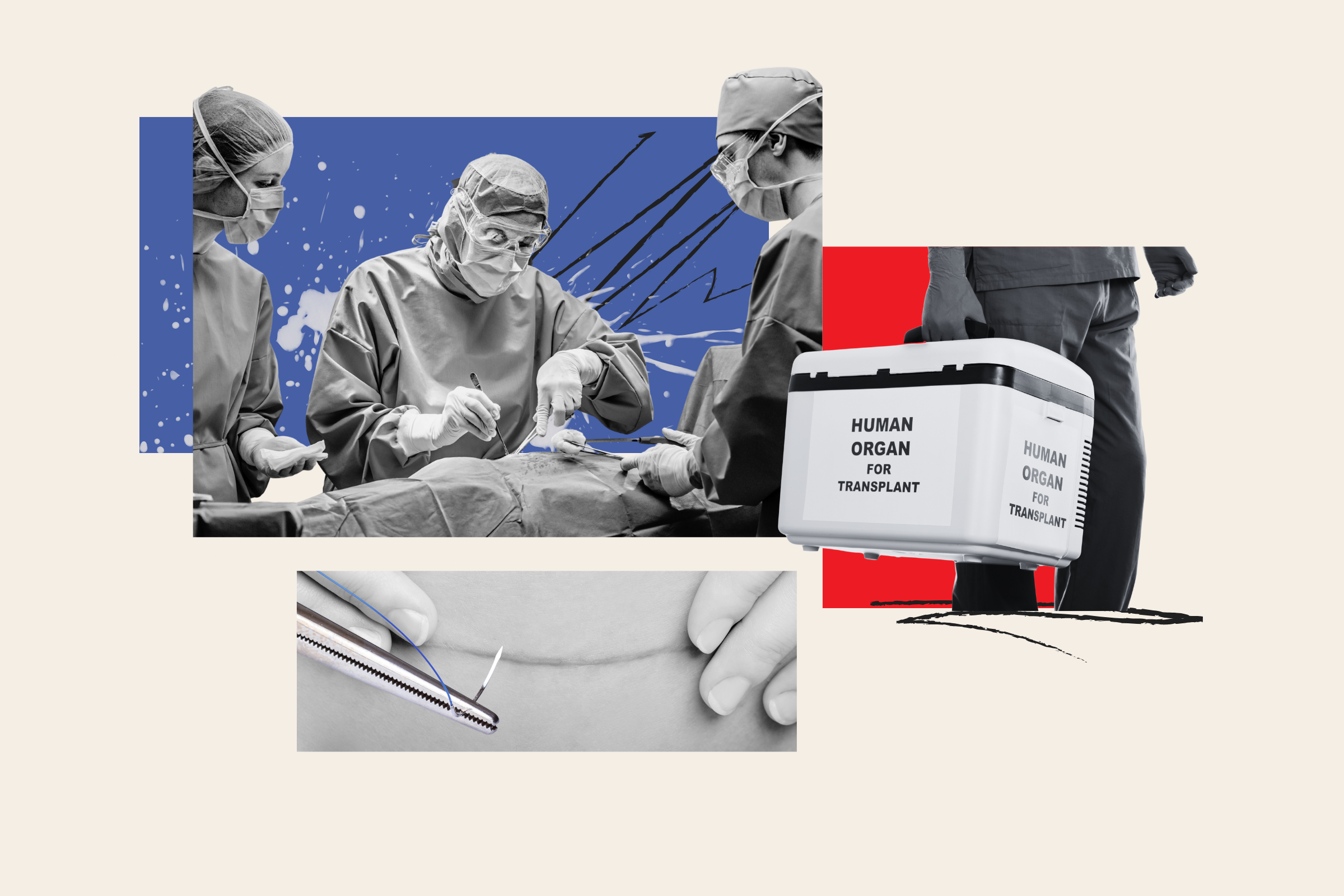 Mass Exodus From Organ Donor Registries Following Media Coverage