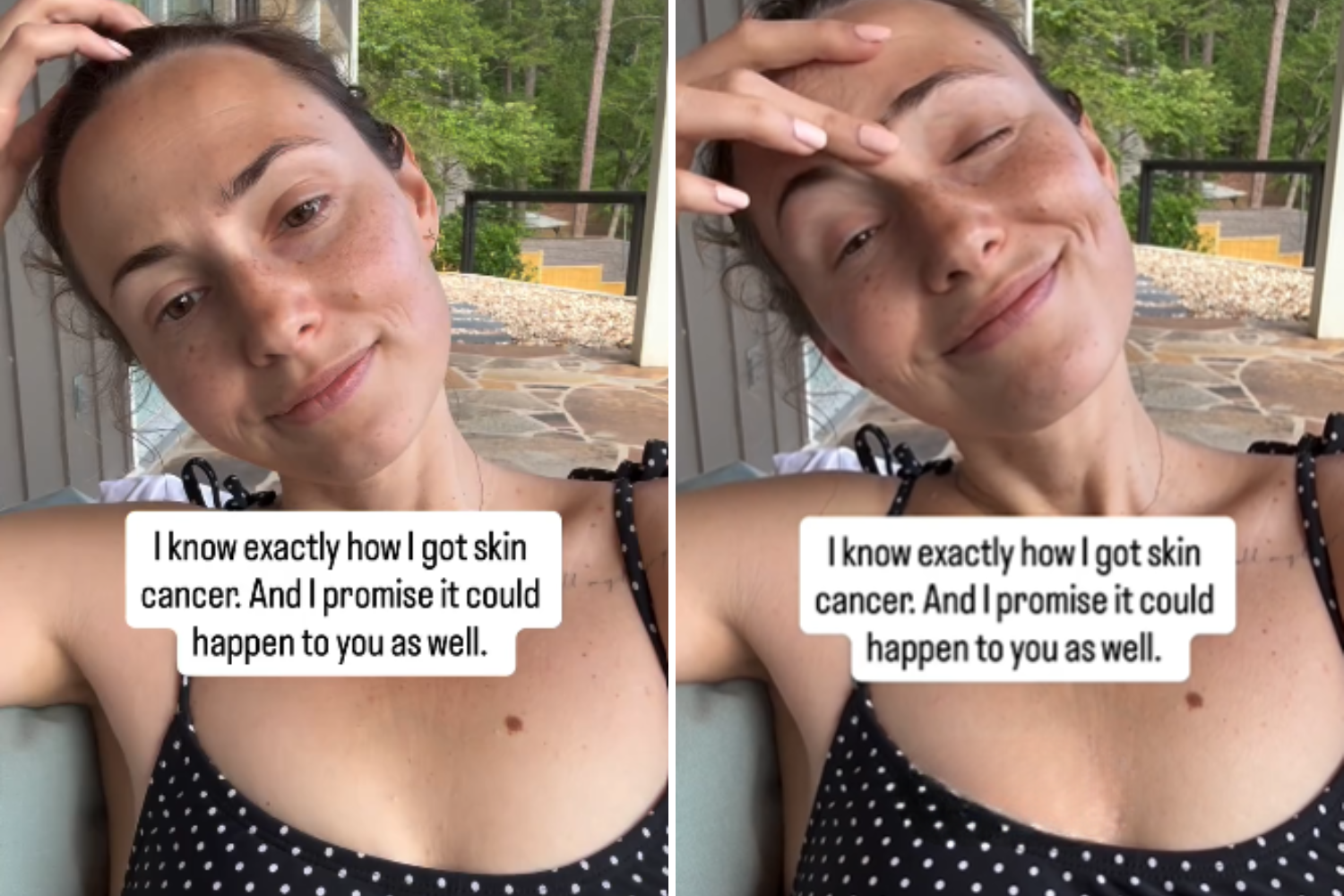 Millennial Spent the Summer Gardening in Yard, Then Came Shocking Diagnosis