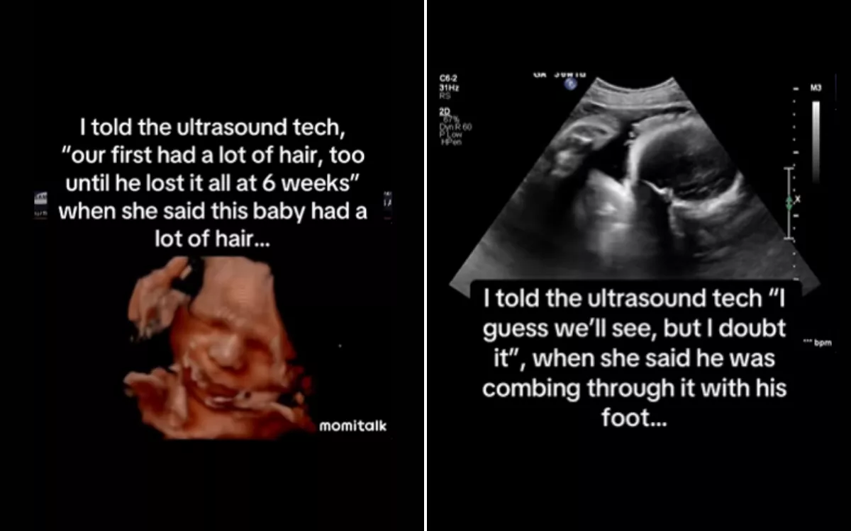Do Ultrasound Techs Know When Something is Wrong? Insights