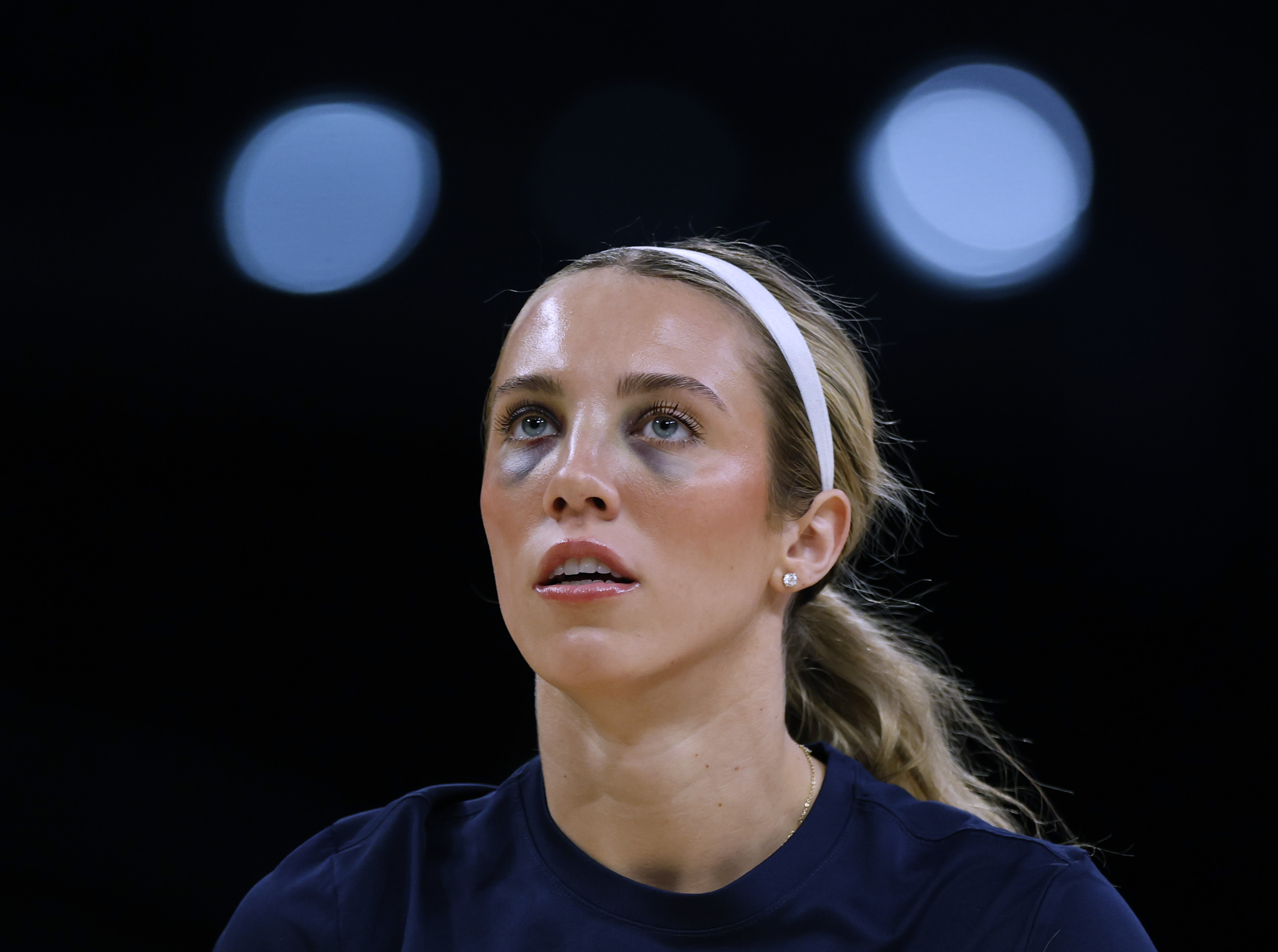 Fever Star Lexie Hull Shares Black Eyes Update After Collision in WNBA Game  - Newsweek