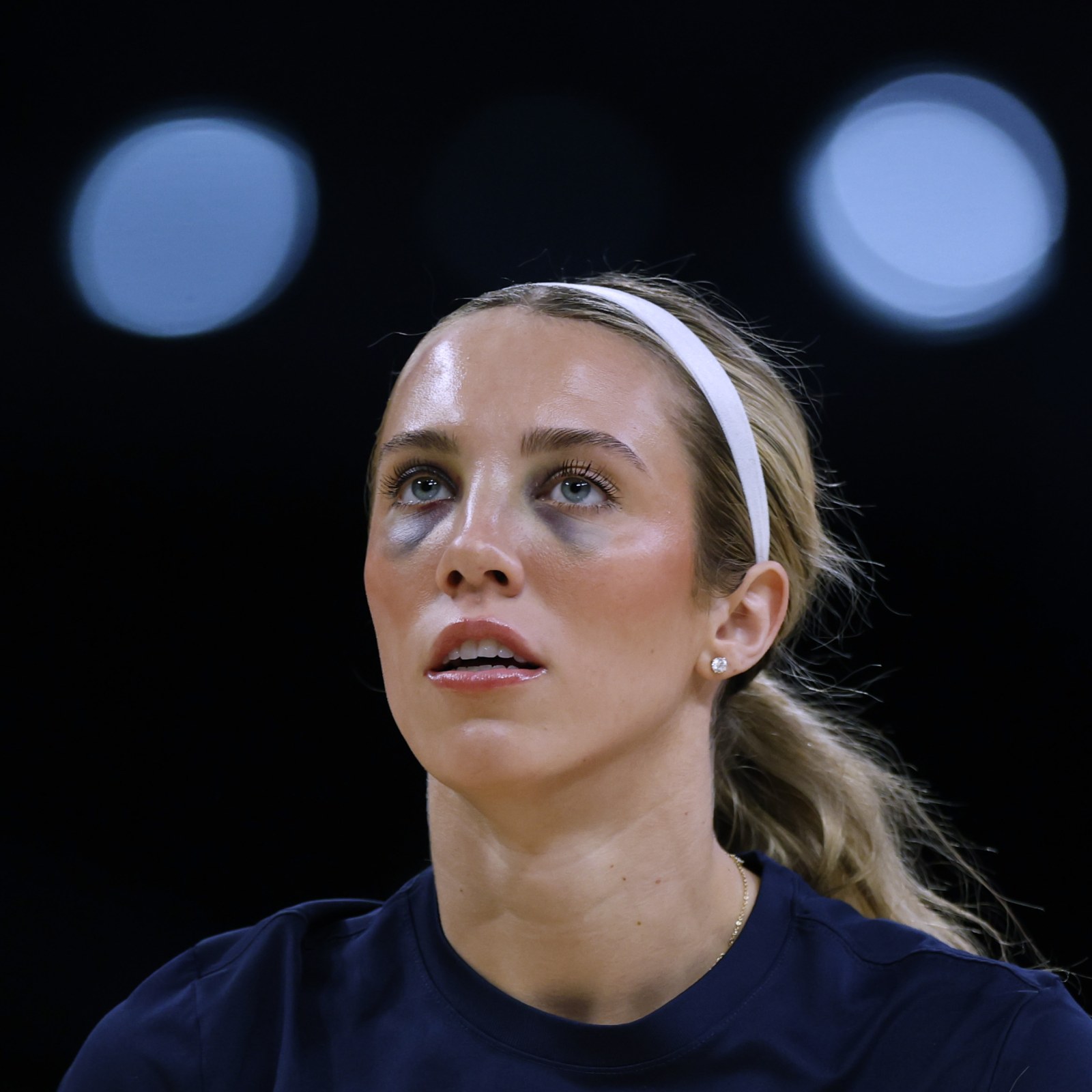 Fever Star Lexie Hull Shares Black Eyes Update After Collision in WNBA Game - Newsweek