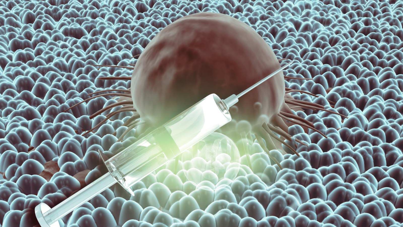 Russia Cancer Vaccine: What To Know About Enteromix Claims