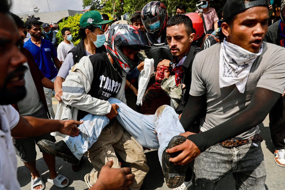 Nepal protests injured victim