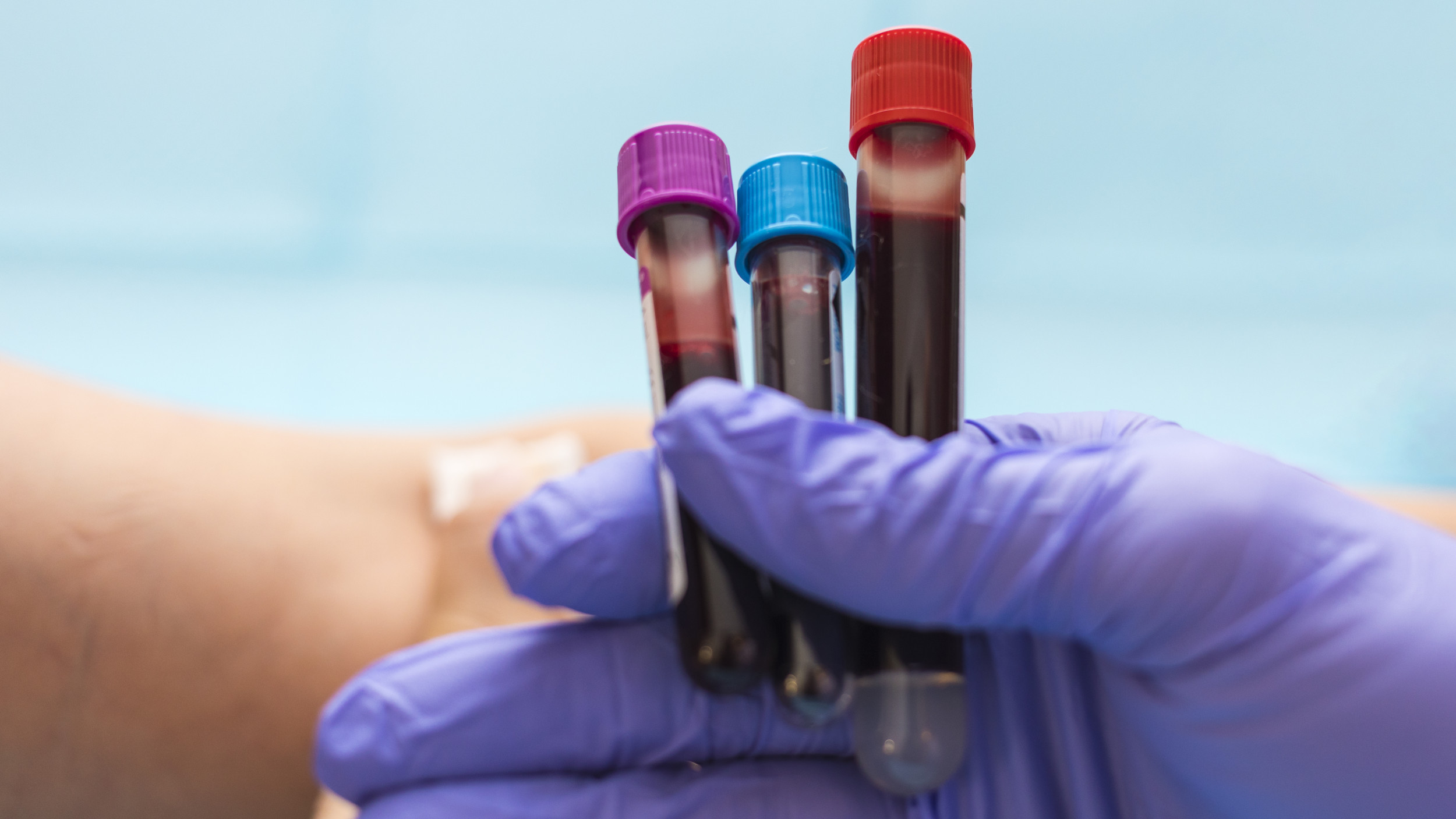 New Blood Test Gives Cancer Warning 10 Years Early