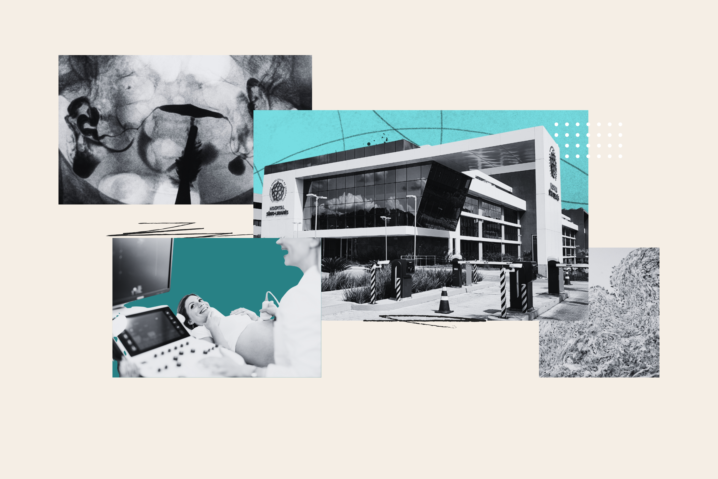 Fibroids Affect Millions - So Why Do Many Women Still Wait Years for Treatment? Fibroids Affect Millions - So Why Do Many Women Still Wait Years for Treatment?