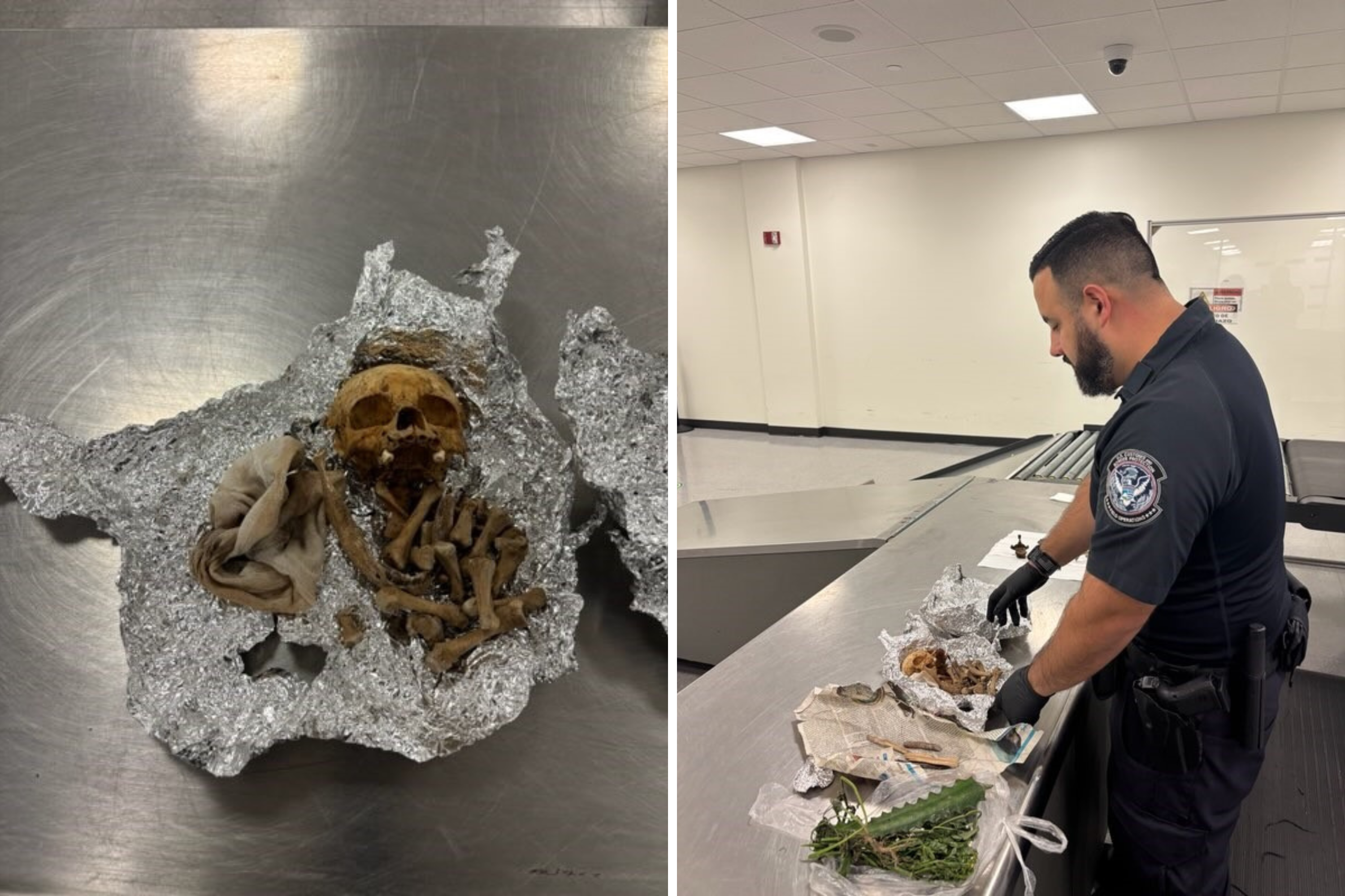 Human Skull and Bones Found in Passengers Bag At Florida Airport