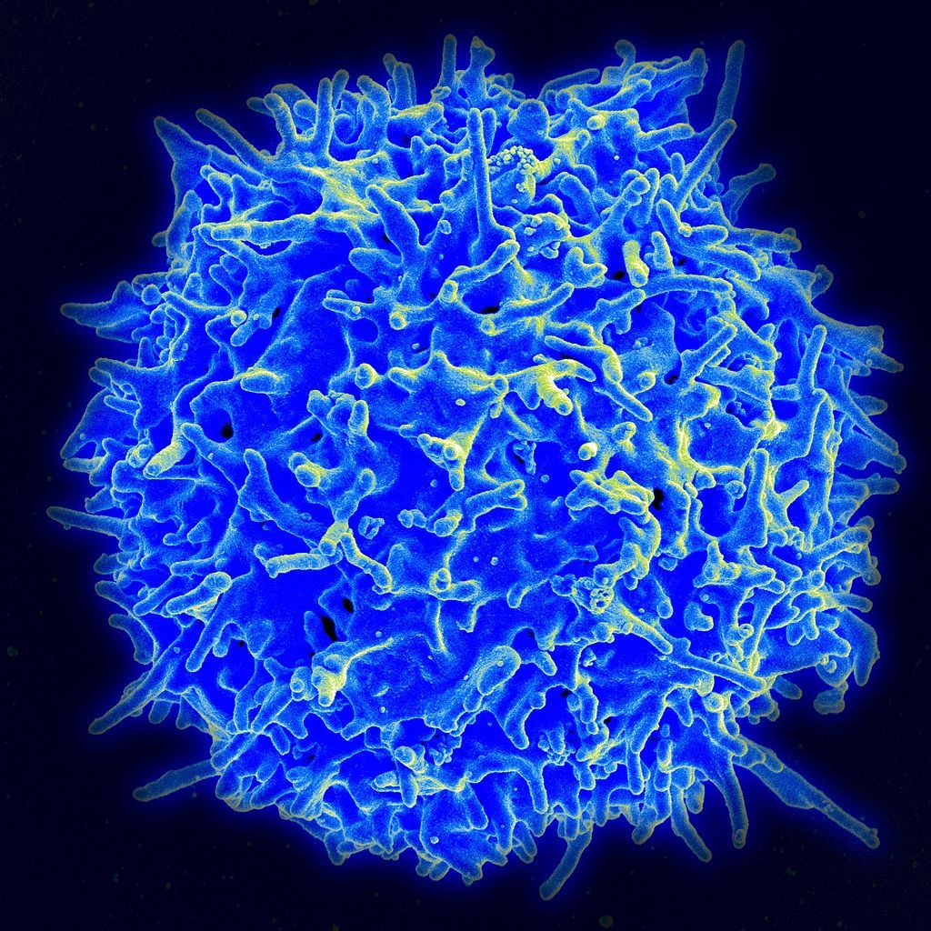 1024px-Healthy_Human_T_Cell