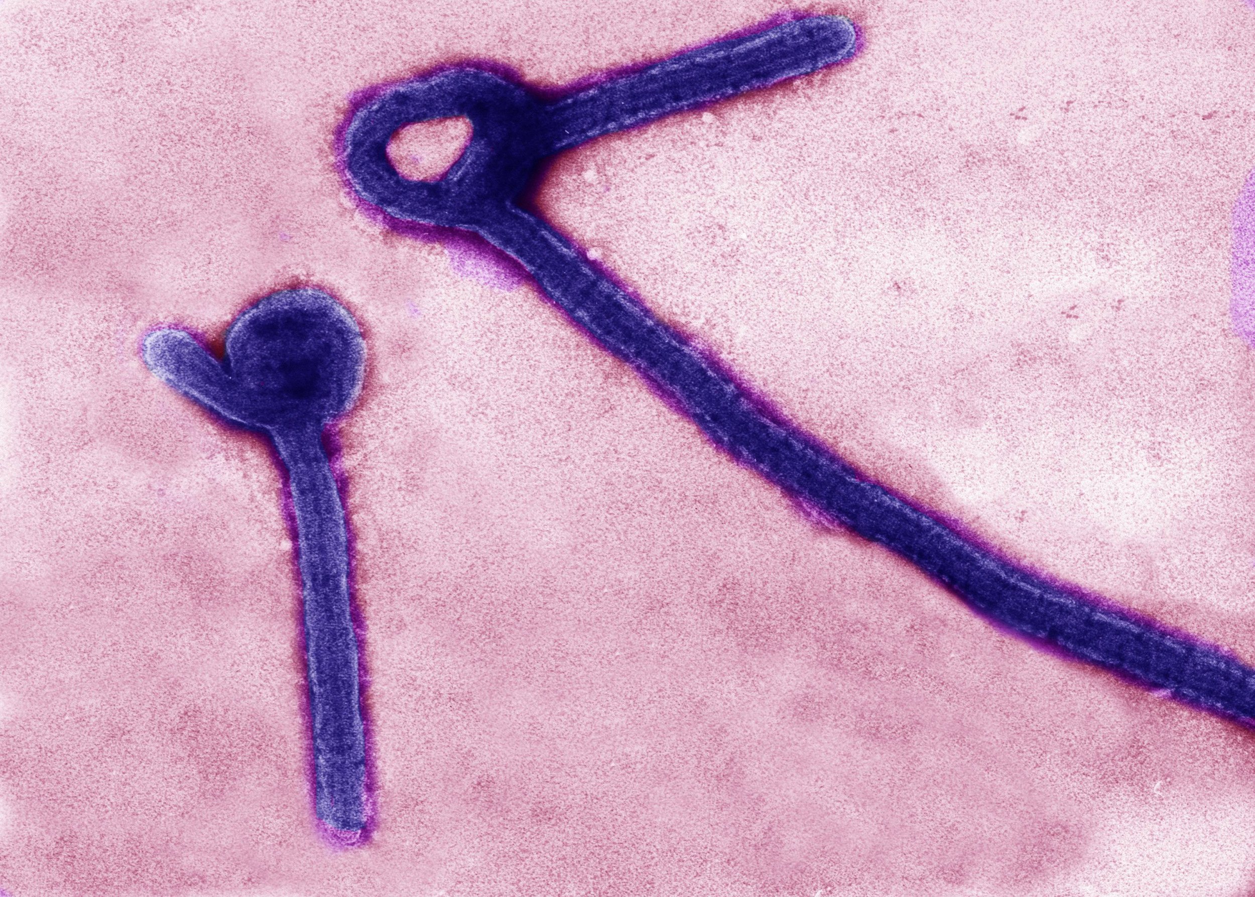 electron micrograph of Ebola virus