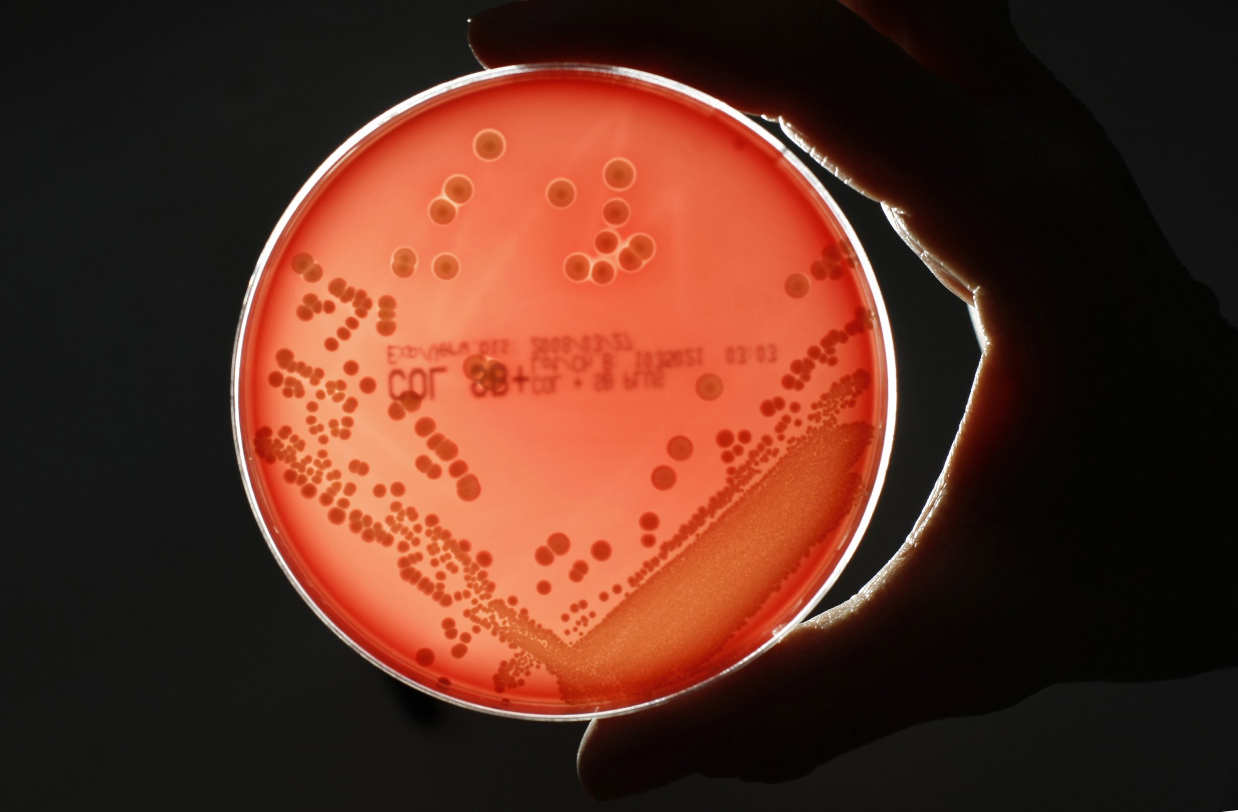 Premium Photo  Staphylococcus aureus antibiotic resistant bacteria