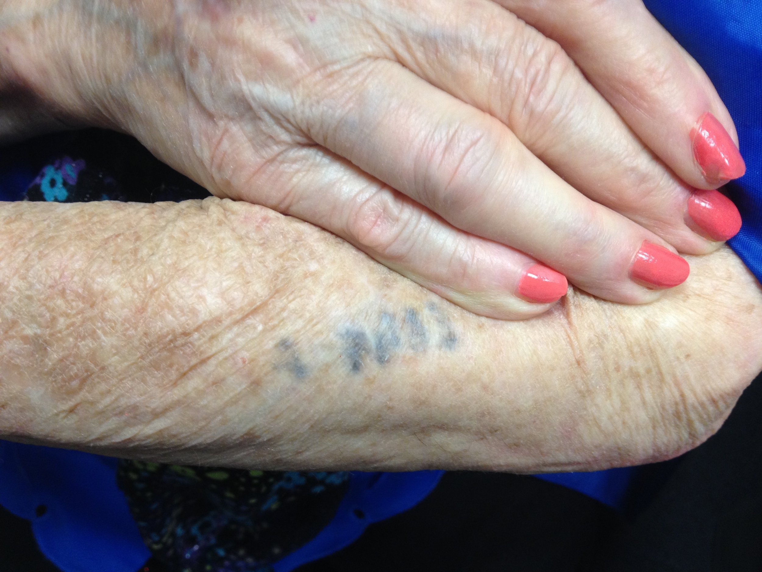 Quora Question What do Holocaust Survivors Think of Their Tattoos?