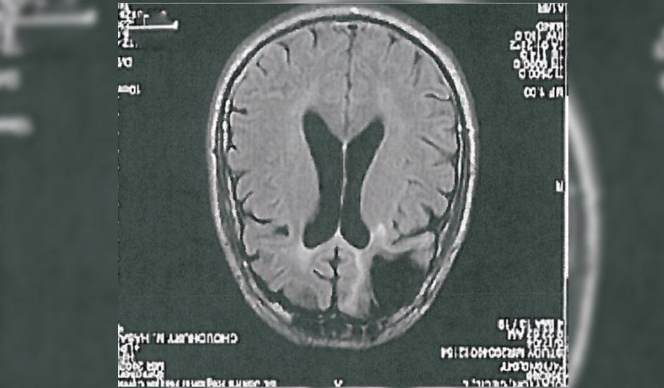 brain scan 02