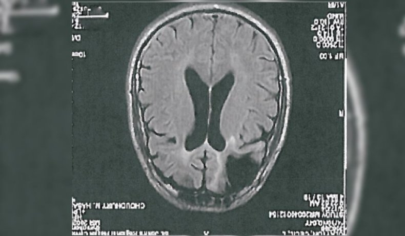brain scan 02