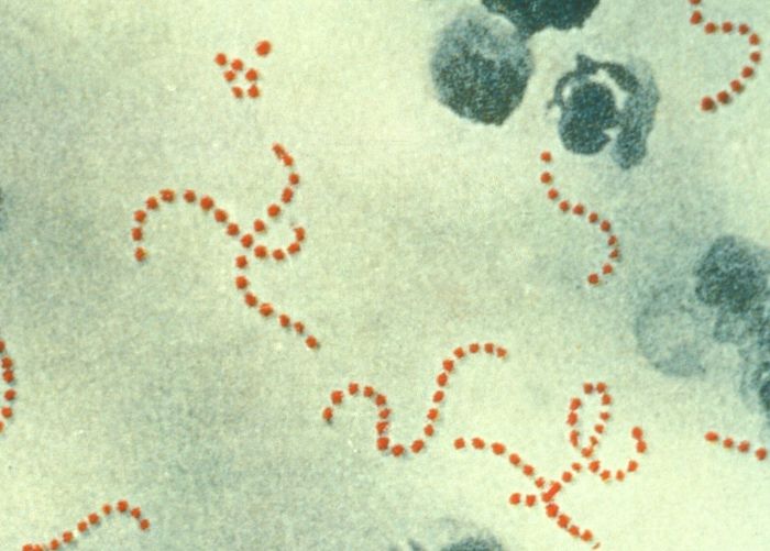 Strep's Dangerous Cousin, Sometimes Flesh-Eating, Spreading Round World