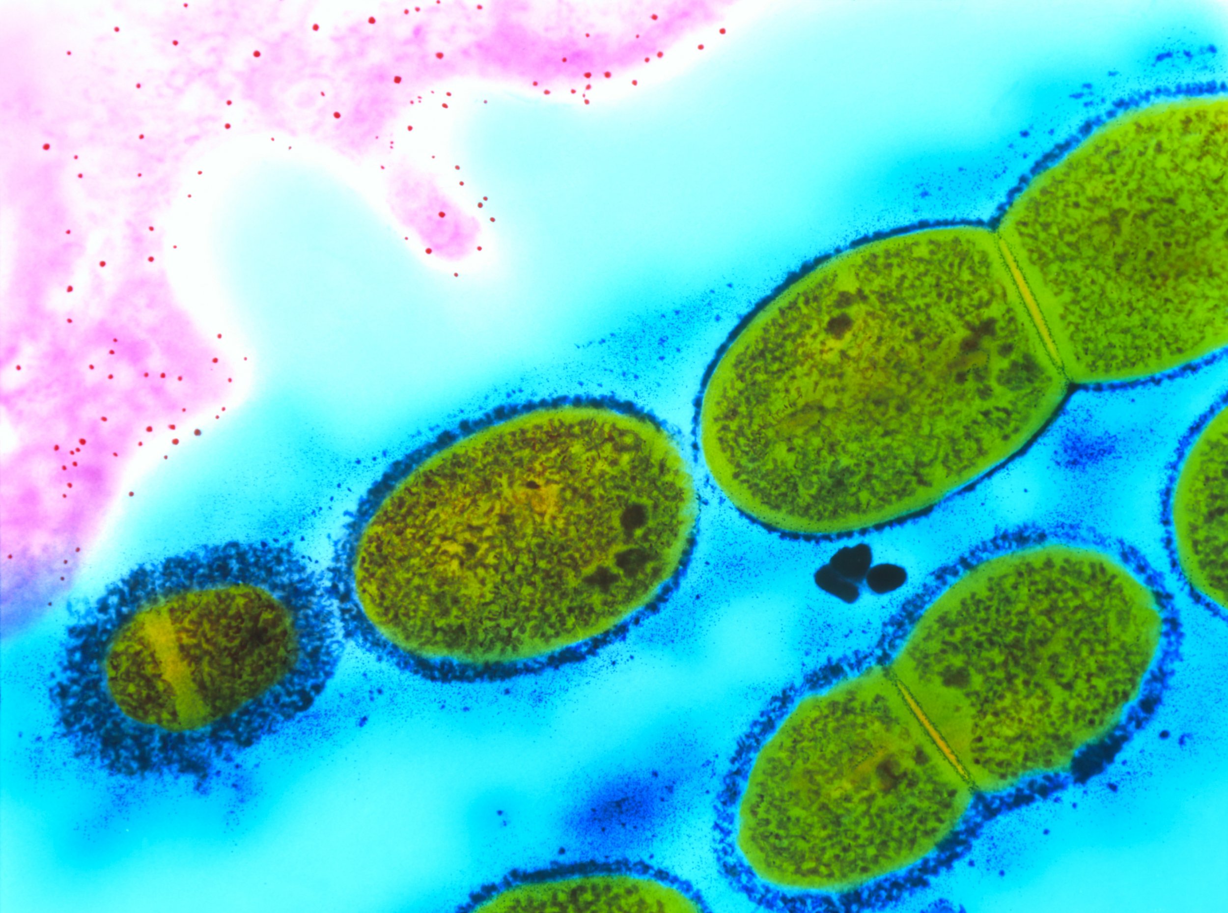 Бактерии домашних условиях. Клеточные микробы. Термофильные микроорганизмы. Бактерии стрептококки.