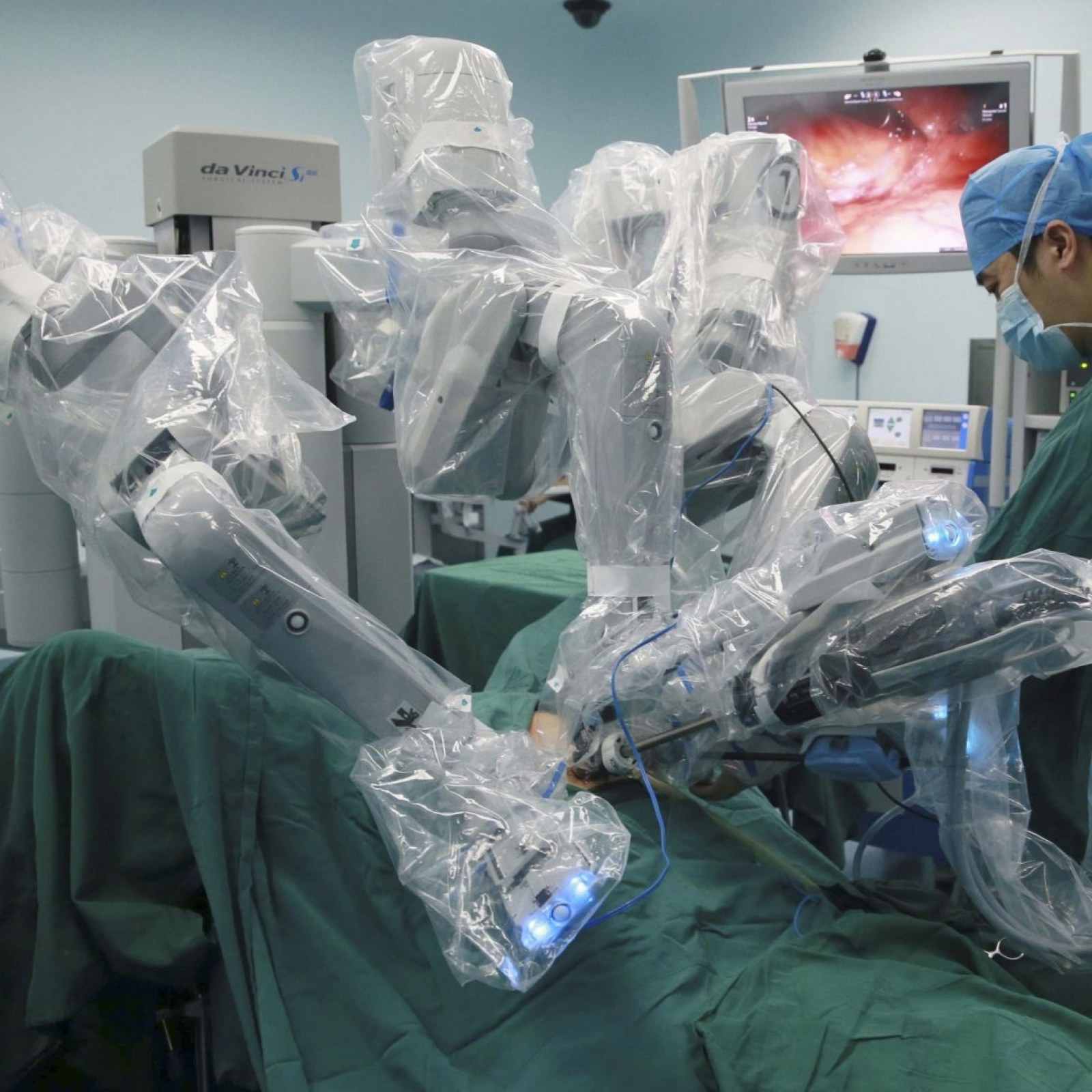 Операция 5 минут. Роботизированная хирургия. Роботизированная хирургия мозга. Робот-хирург в теле человека.