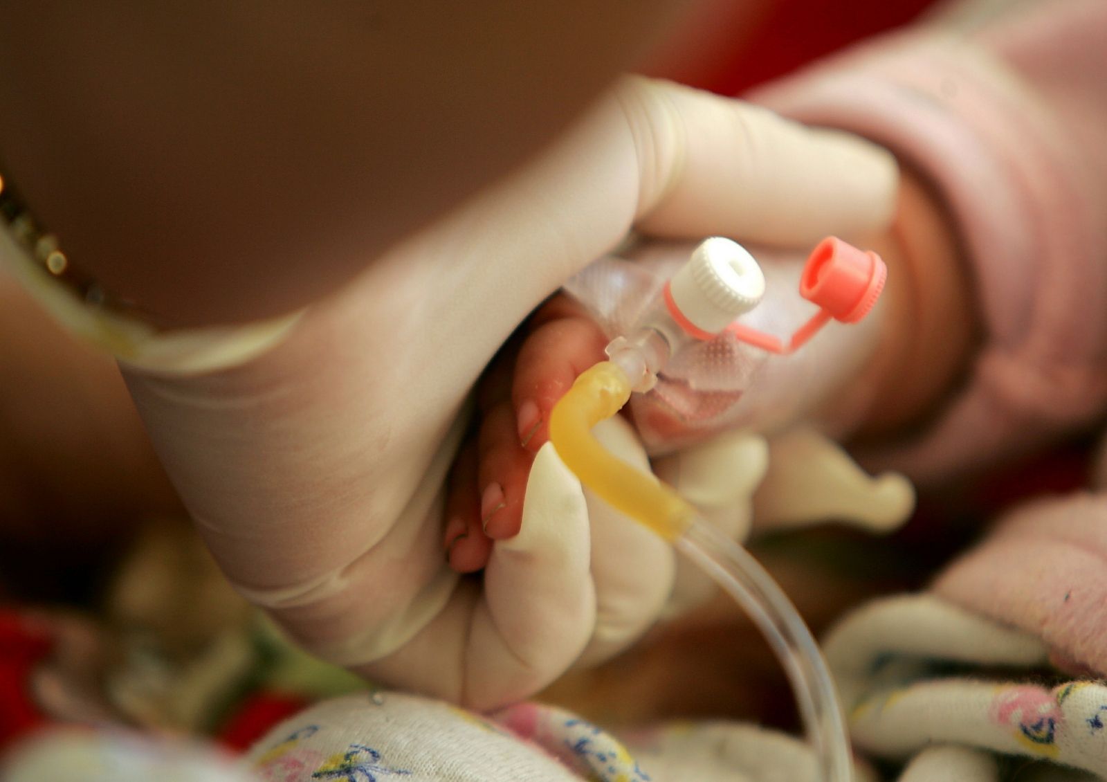 Teen in remission from HIV without drugs