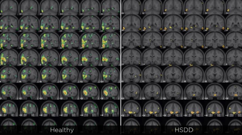 Brain Scans