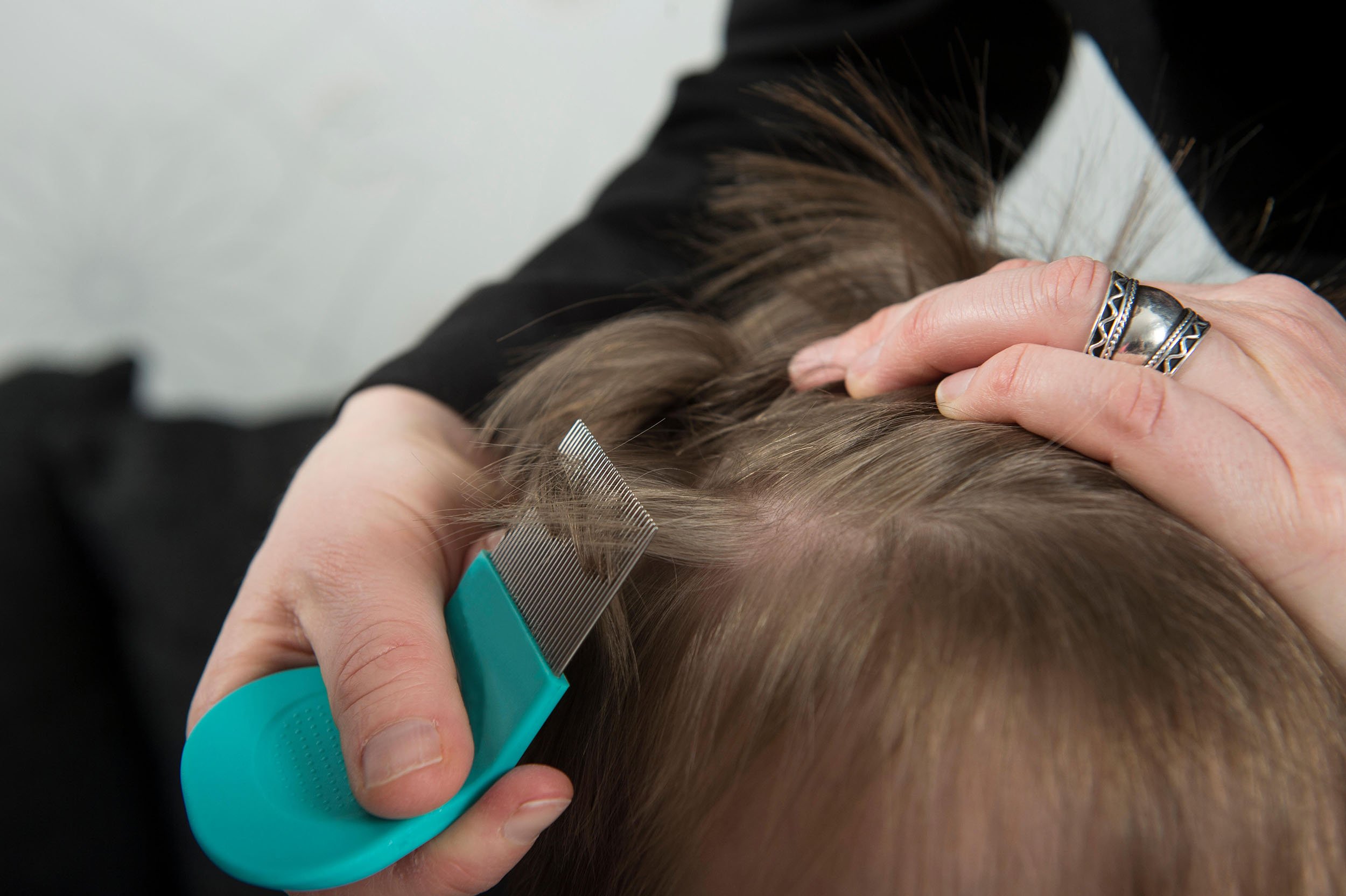 Lice Are Becoming Resistant to Treatment