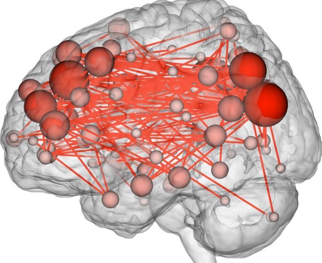 Image of brain fingerprint from Yale study