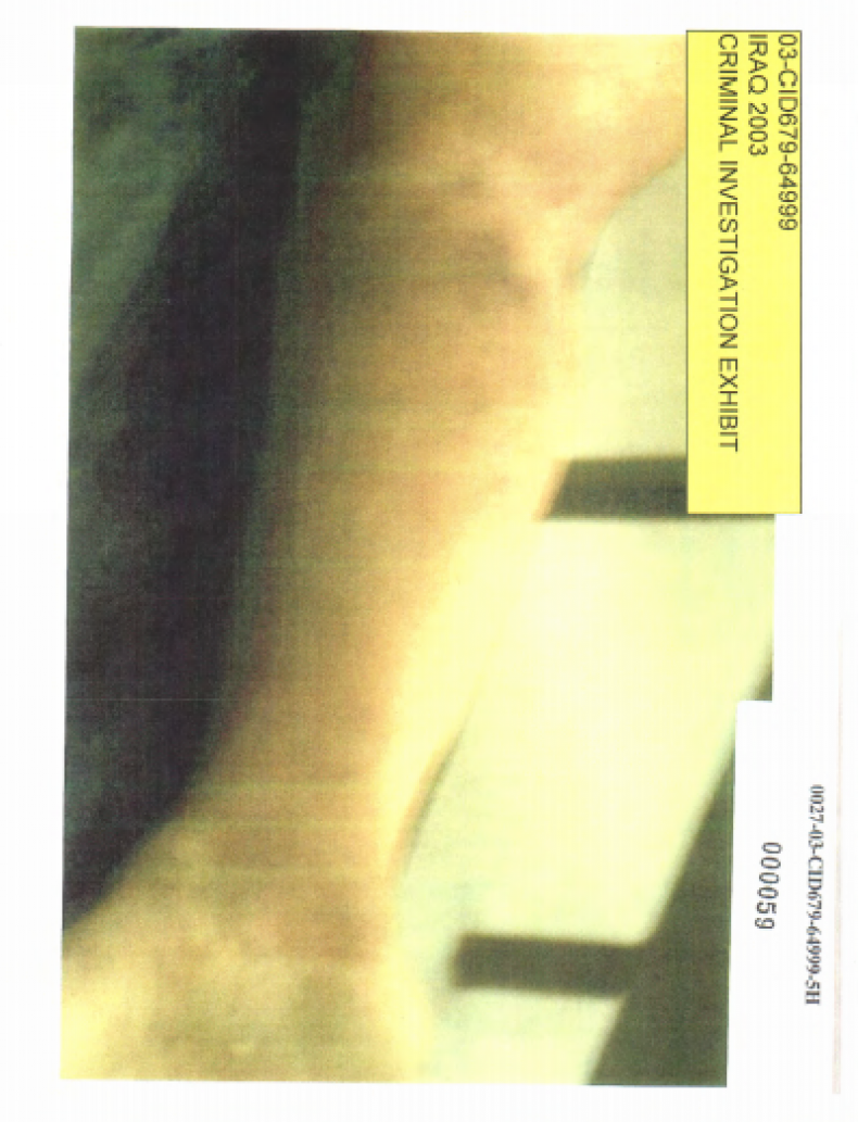 detainee3