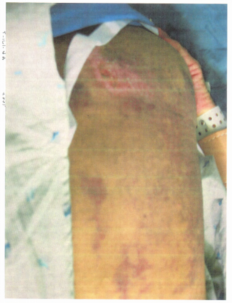 detainee7