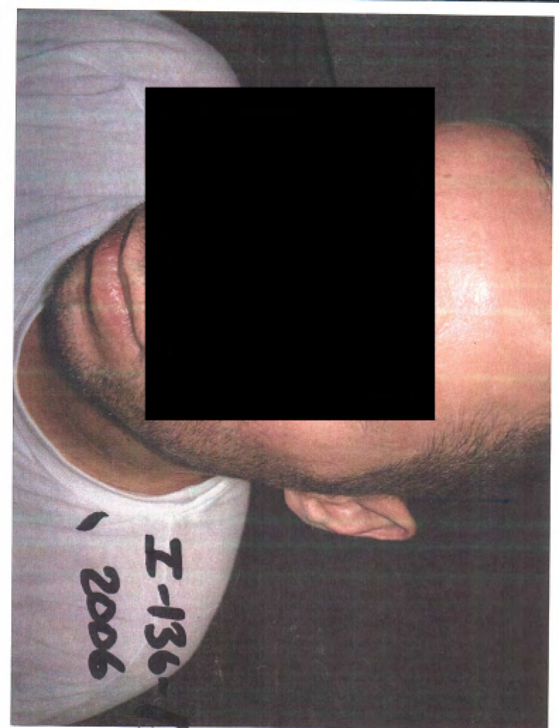 detainee11