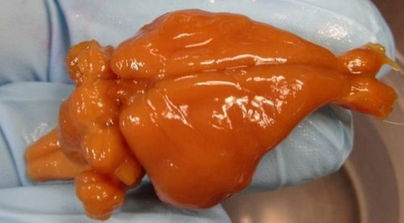 Rabbit brain cryonics cryopreservation 21CM