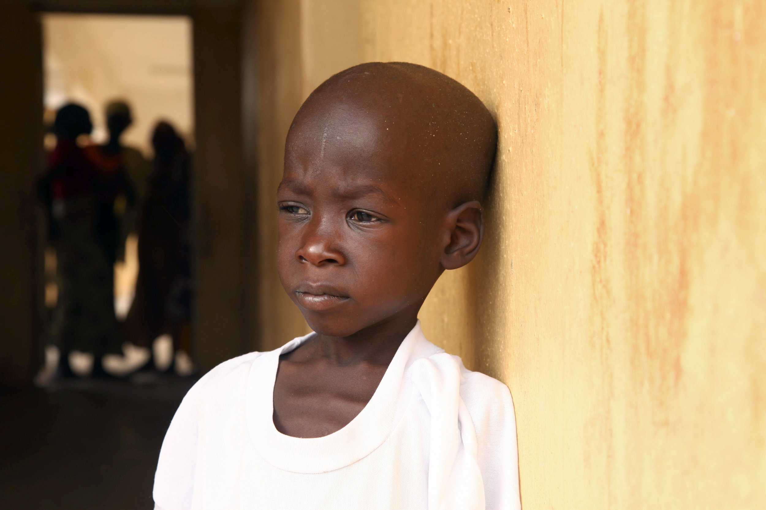 A malnourished Nigerian child rescued from Boko Haram at a refugee camp.