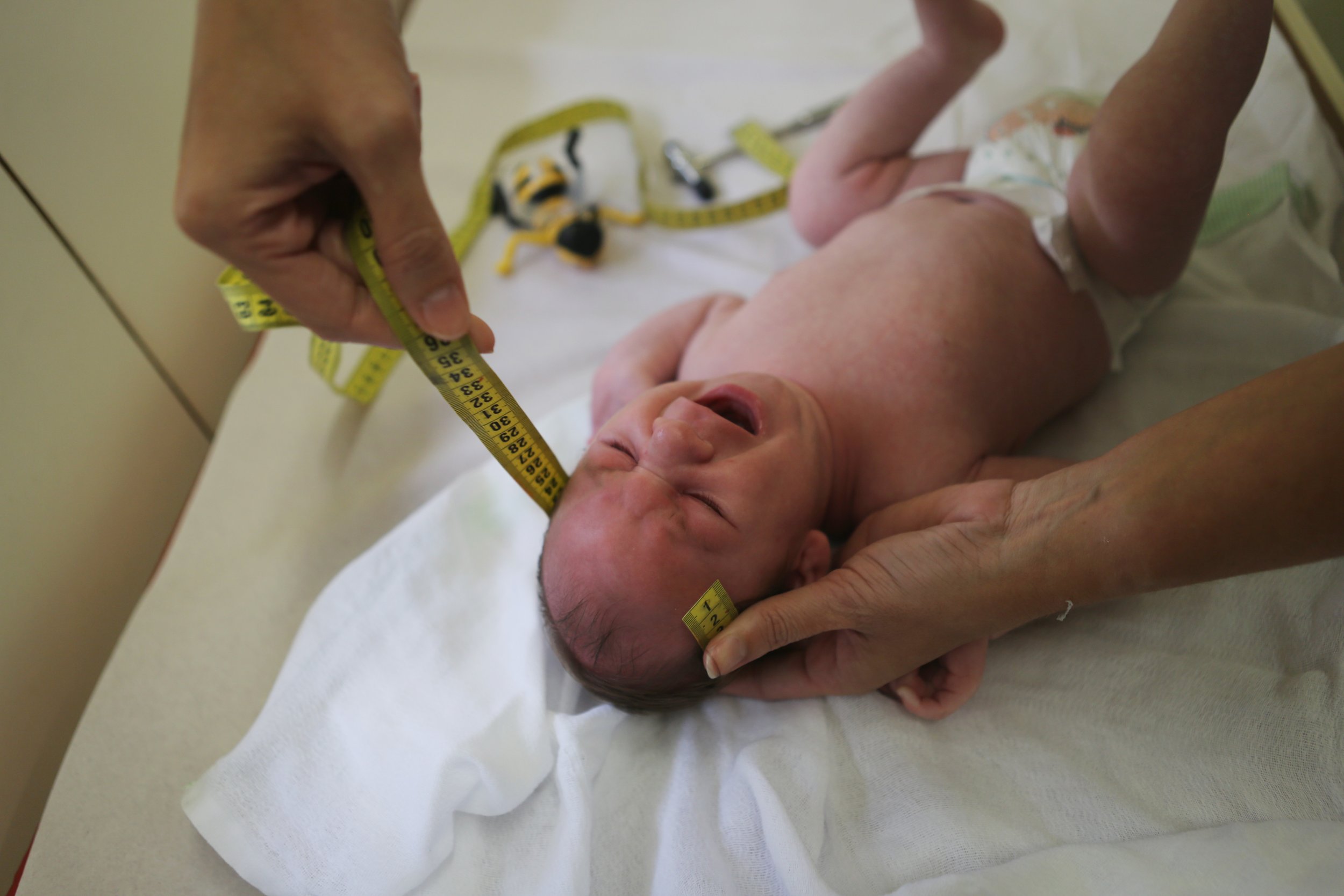 A Brazilian doctor measures the head of a child with microcephaly.