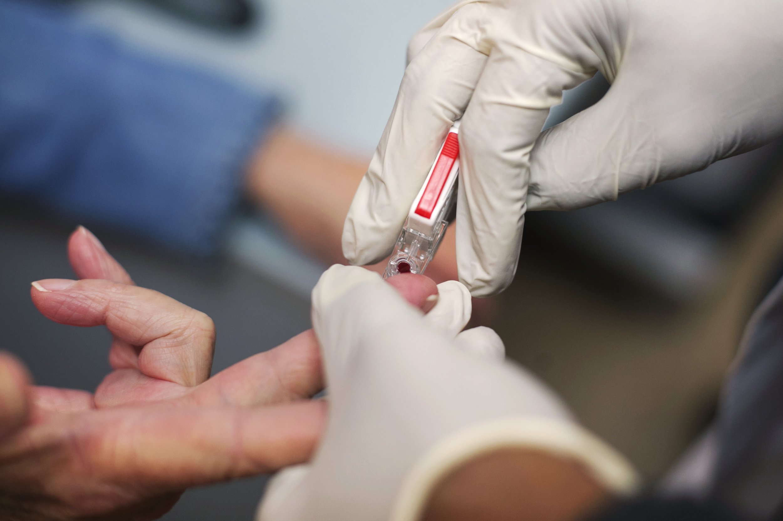 Признак инфицирования крови во флаконе тест