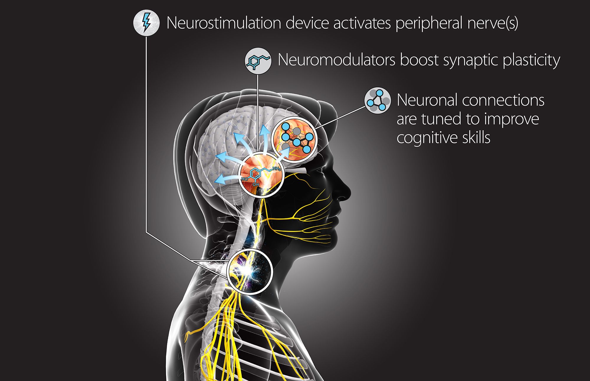 DARPA hack brain neurostimulation device