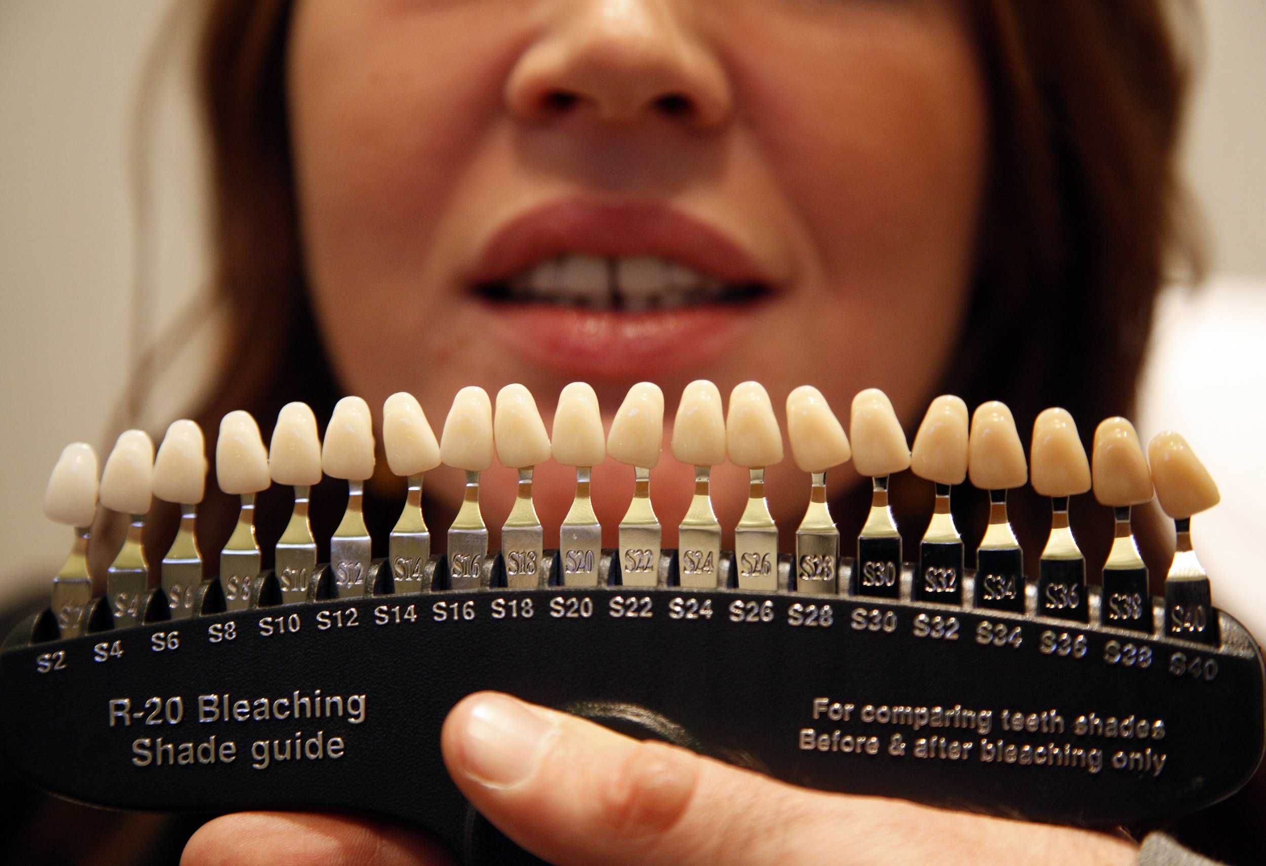 Teeth Whitening Chart