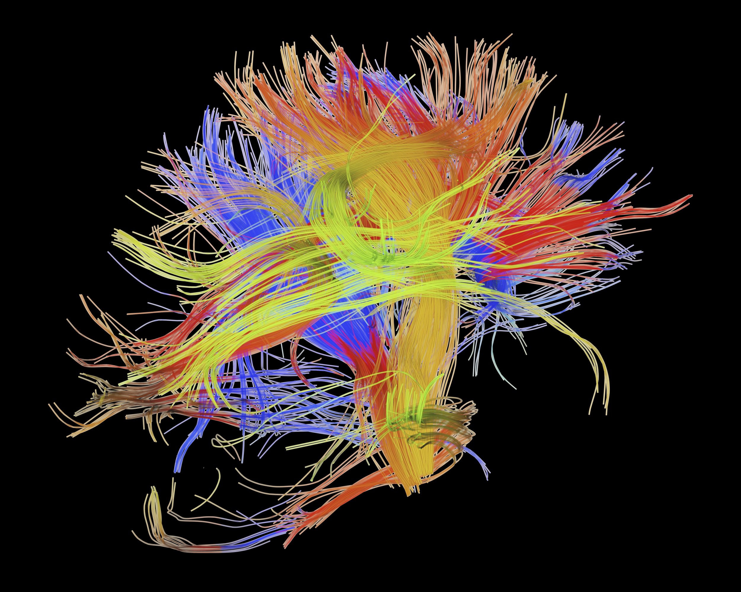 The Wiring Of The Brain