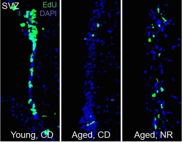 Stem cell decline in aged mice Stem cell decline in aged mice