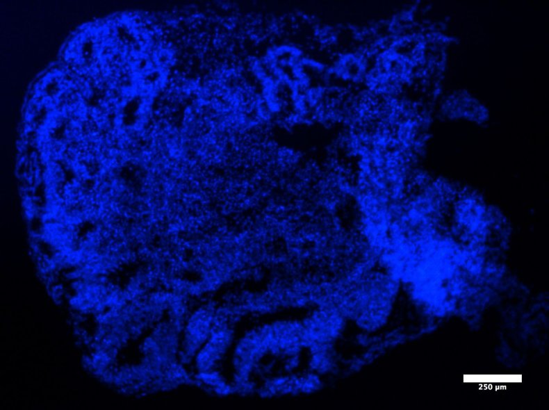 Mini Brains Zika Microcephaly