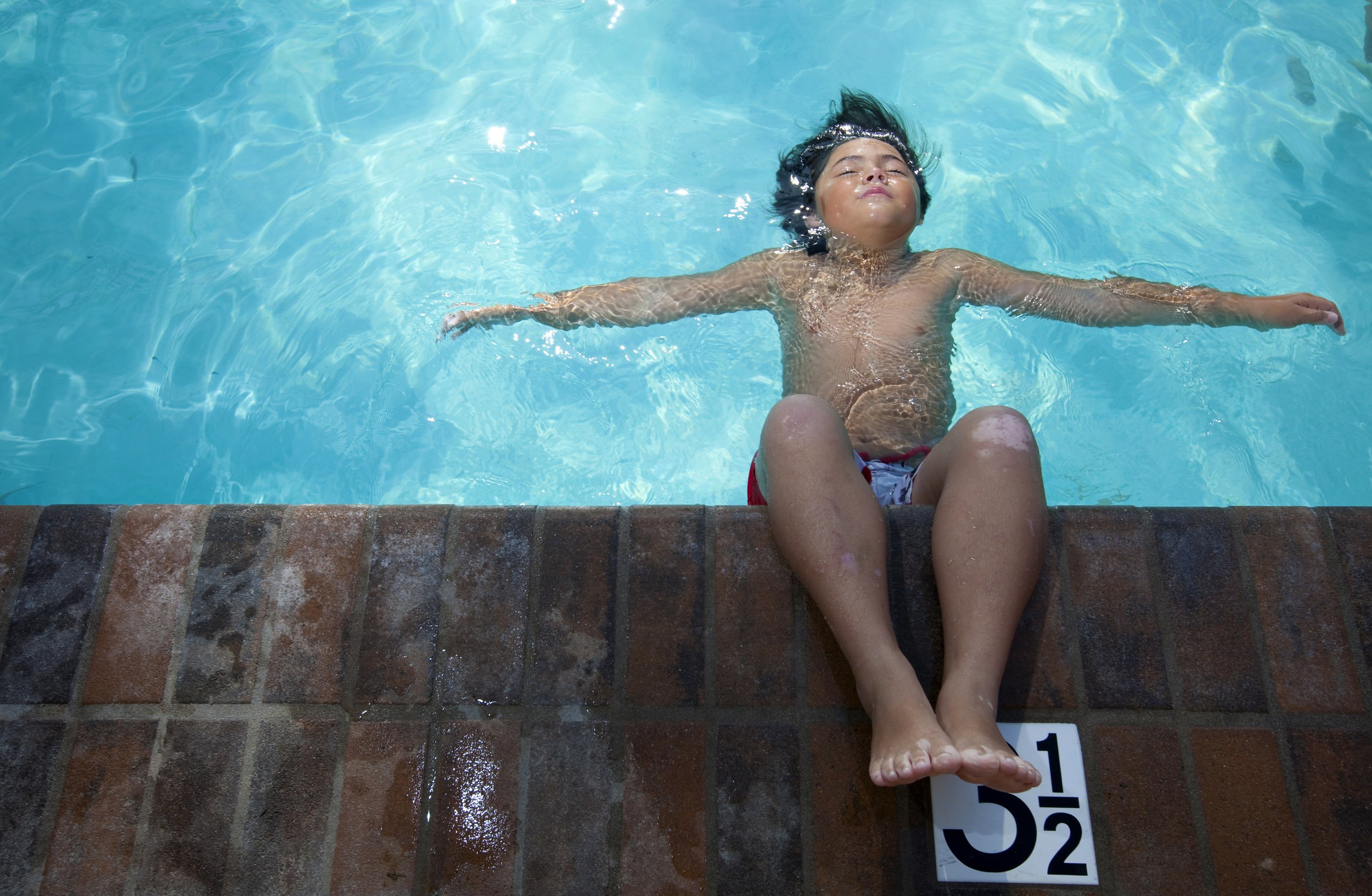 Pee, not chlorine, causes red eyes from swimming pools: CDC