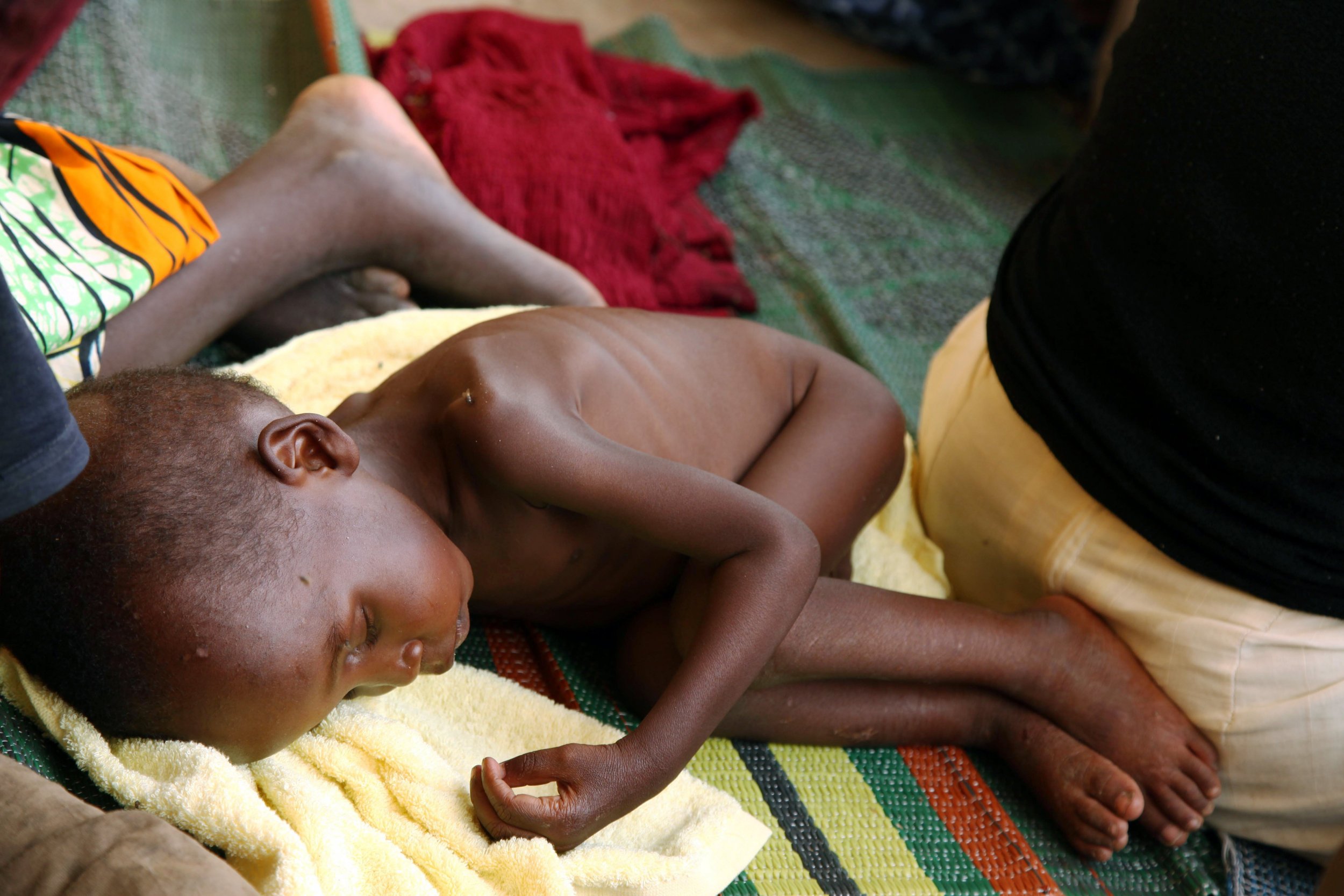 Malnourished child rescued from Boko Haram