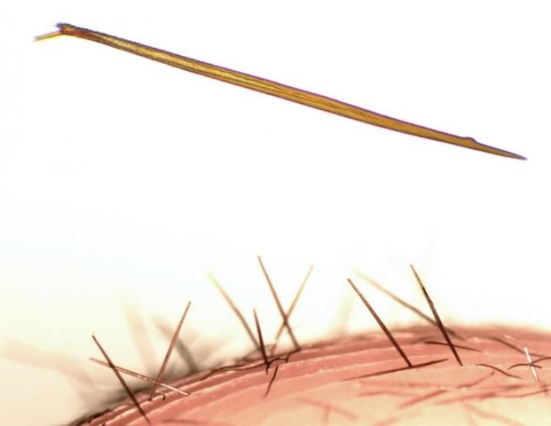 tarantula-hairs