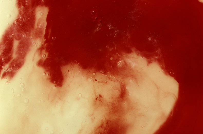 7-15-16 Andres Serrano Blood and Semen 7-15-16 Andres Serrano Blood and Semen