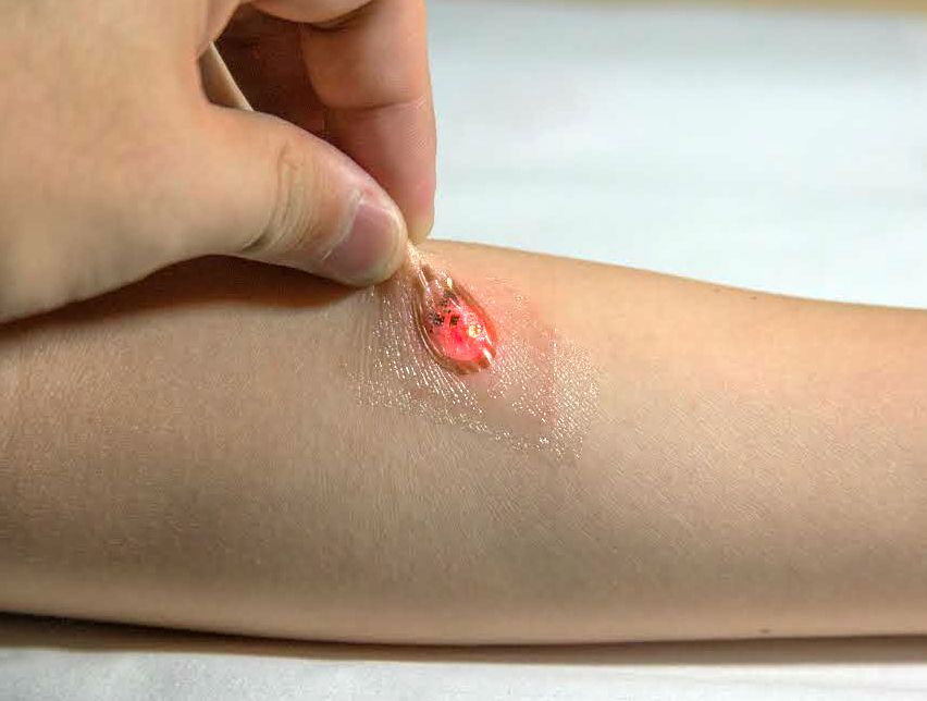 health tattoo medtech sticker science