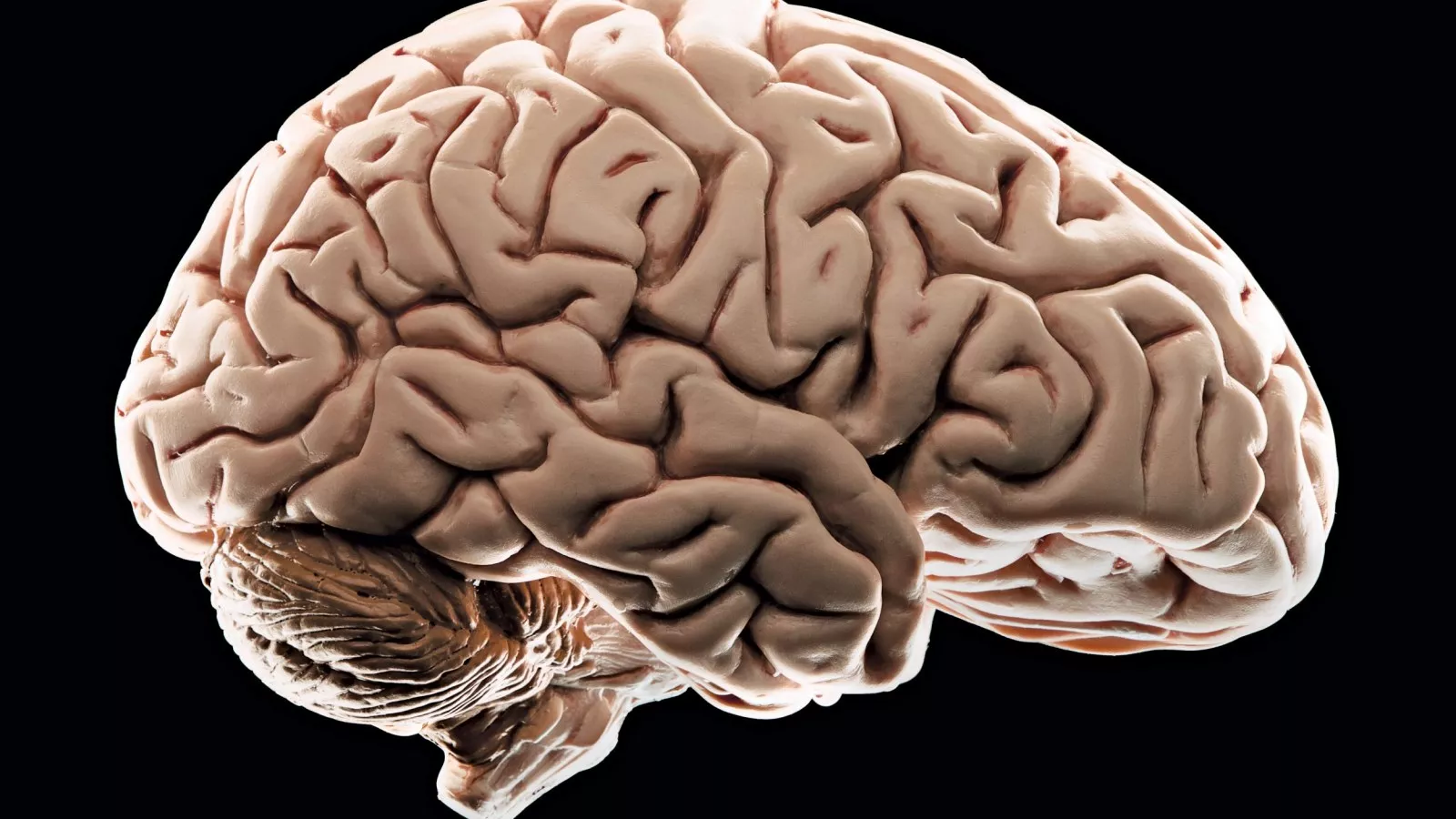startling finds on teenage brains