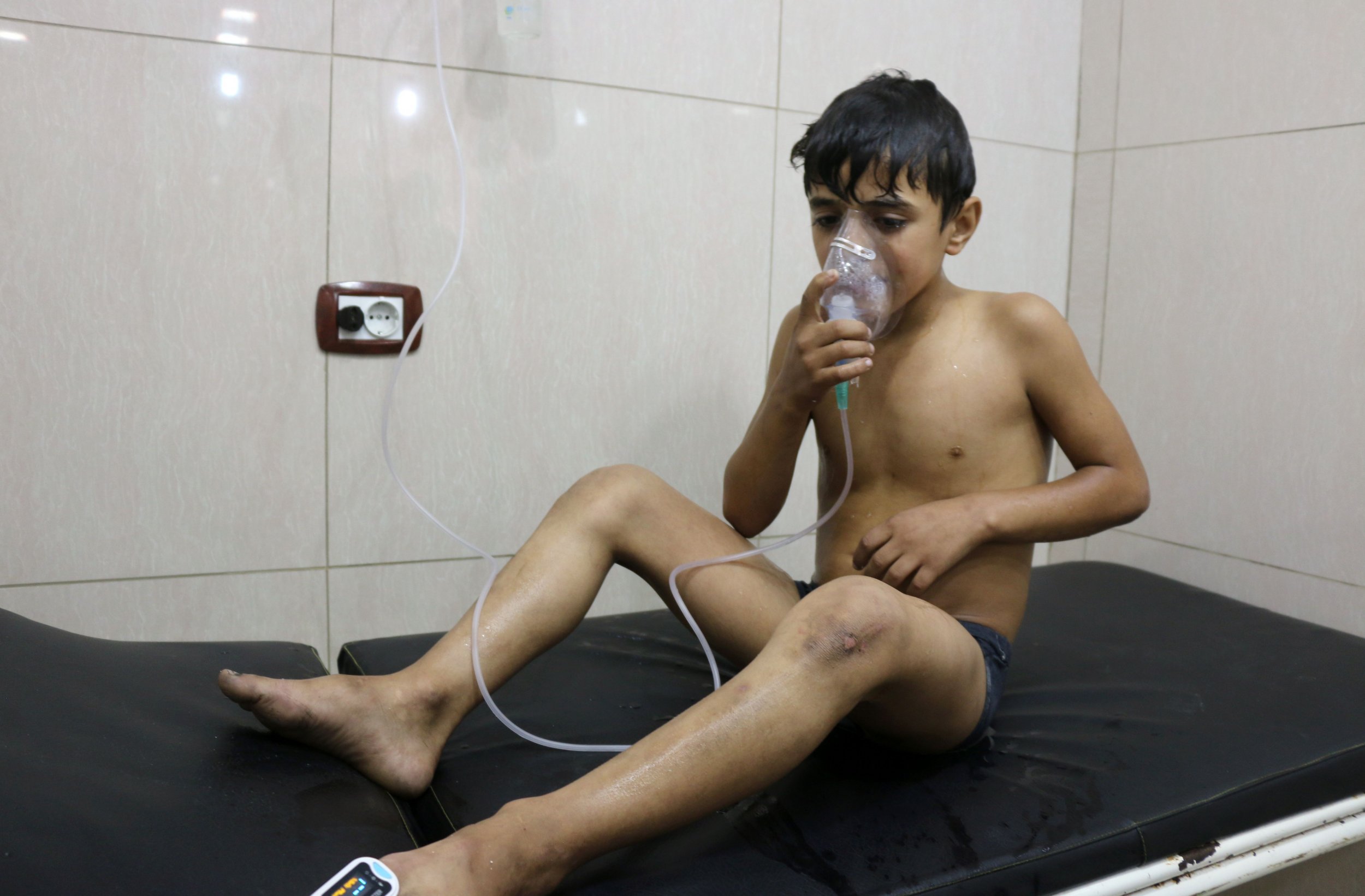 Syrian boy treated for breathing problems in Aleppo